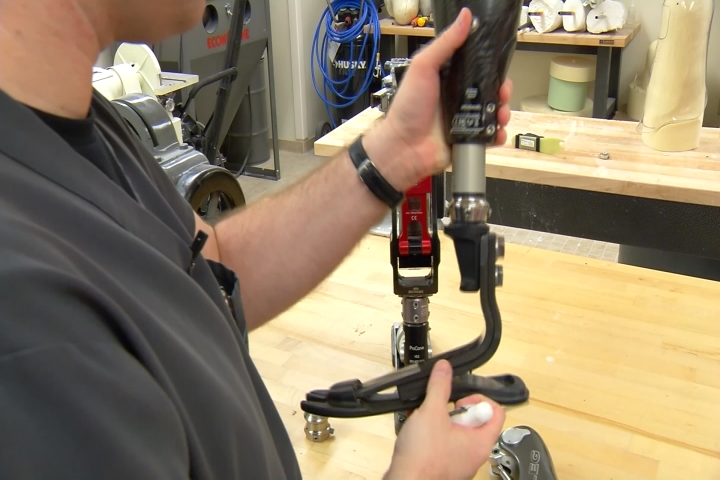 Healthy Living: Smart Parts for Amputees – 9and10News.com