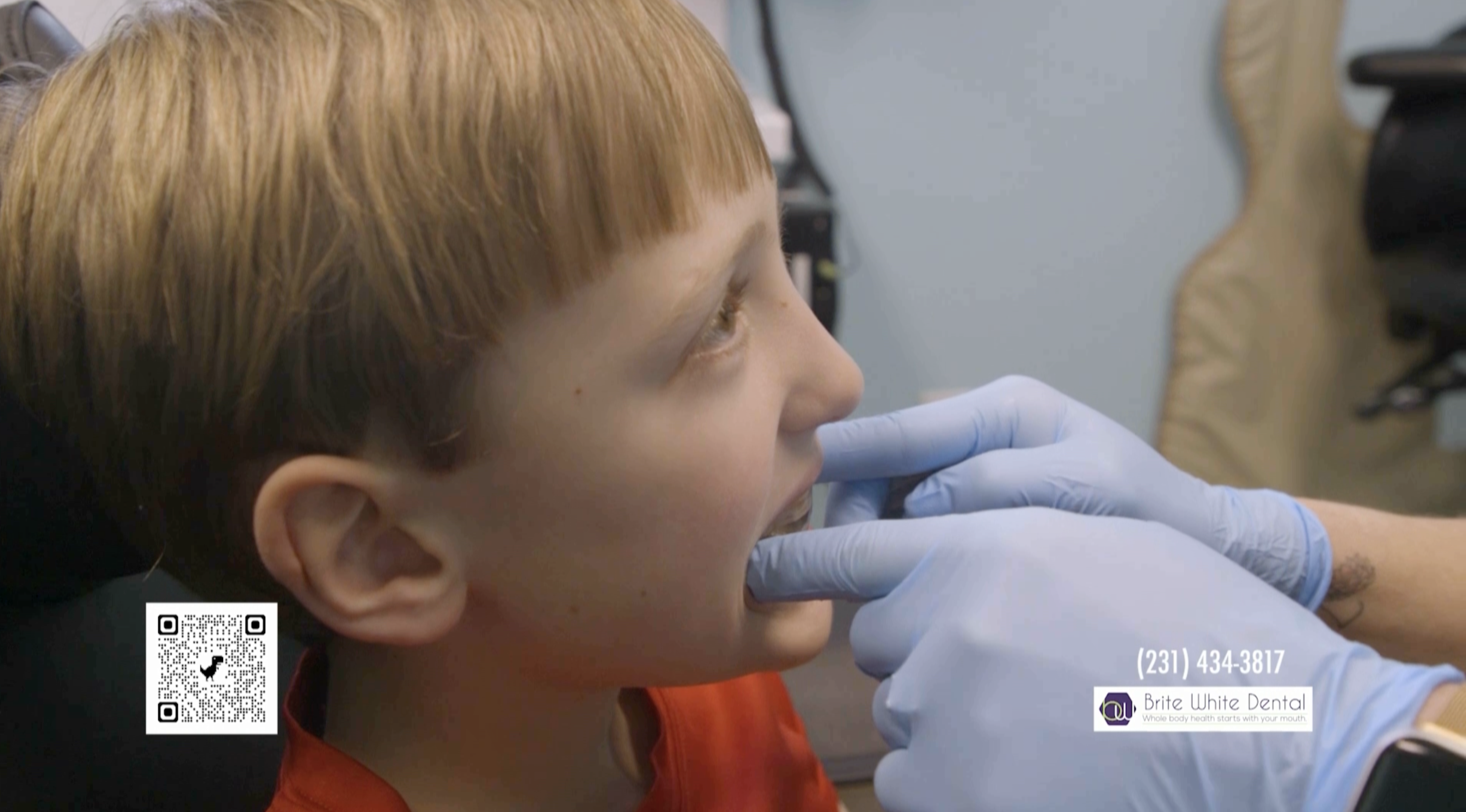 Brite White Dental: The importance of early orthodontic intervention with Healthy Start