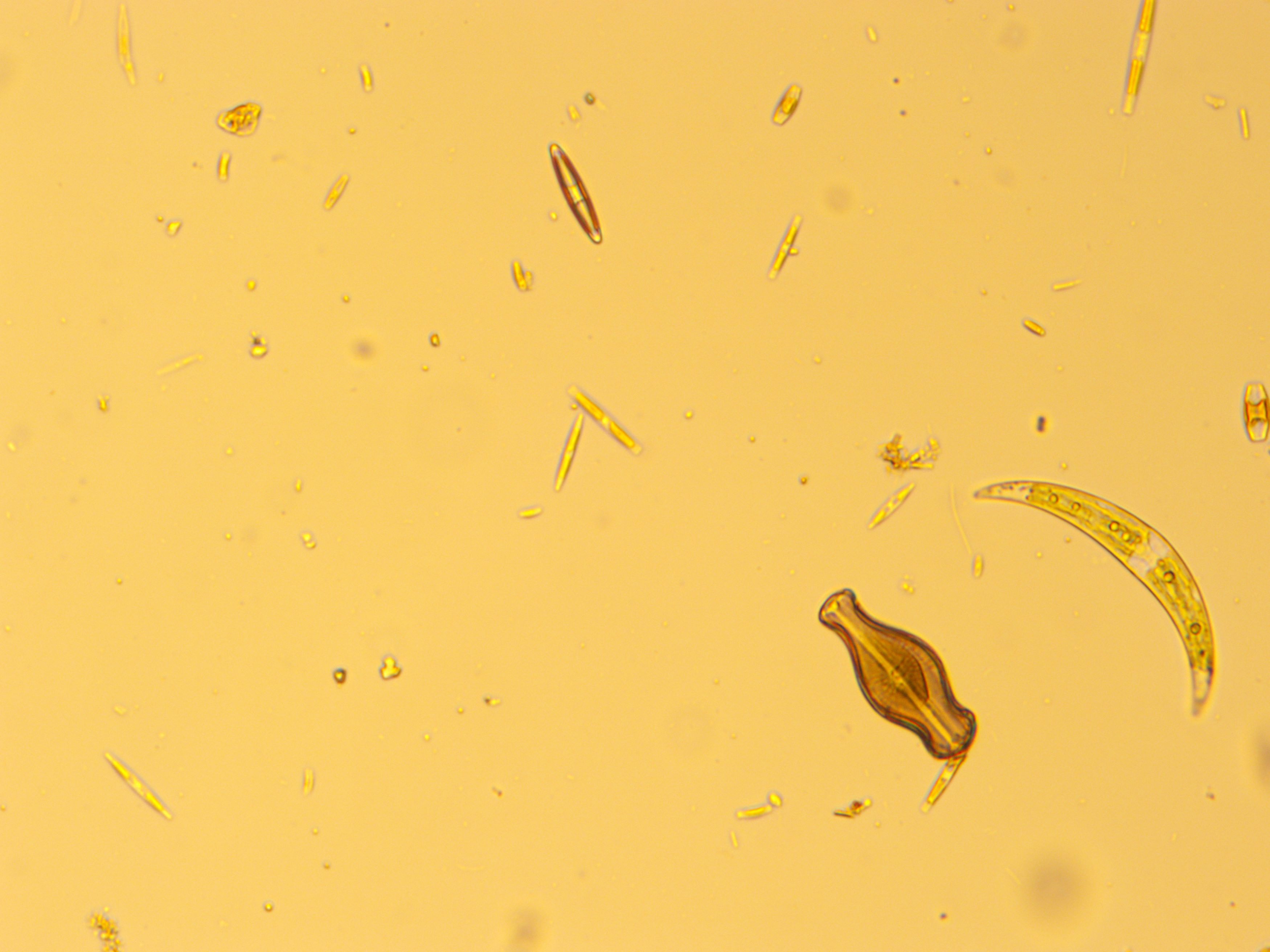 Magnification of a didymo cell (bottom right), evident by its “coke bottle” shape, from a Parmalee Canoe Launch access site sample.