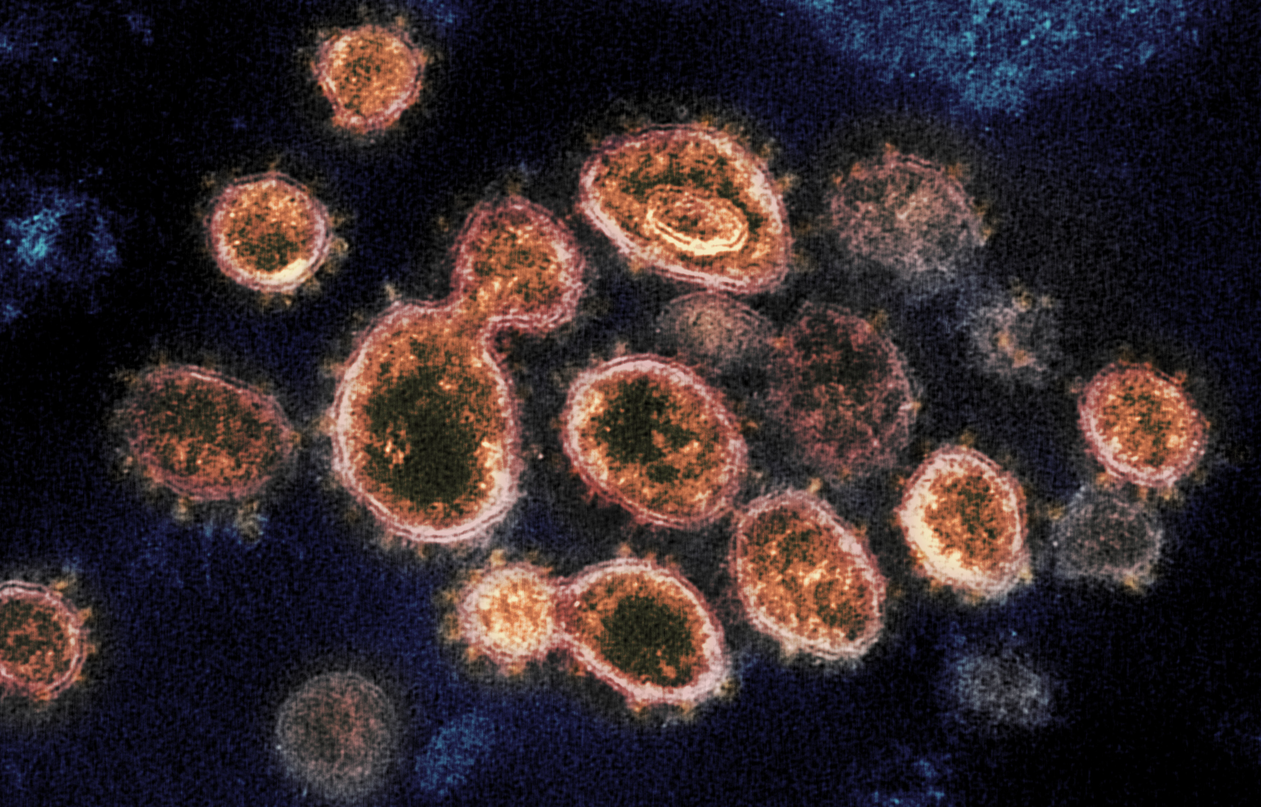 What We Know About The New ‘double Mutant’ Coronavirus Variant