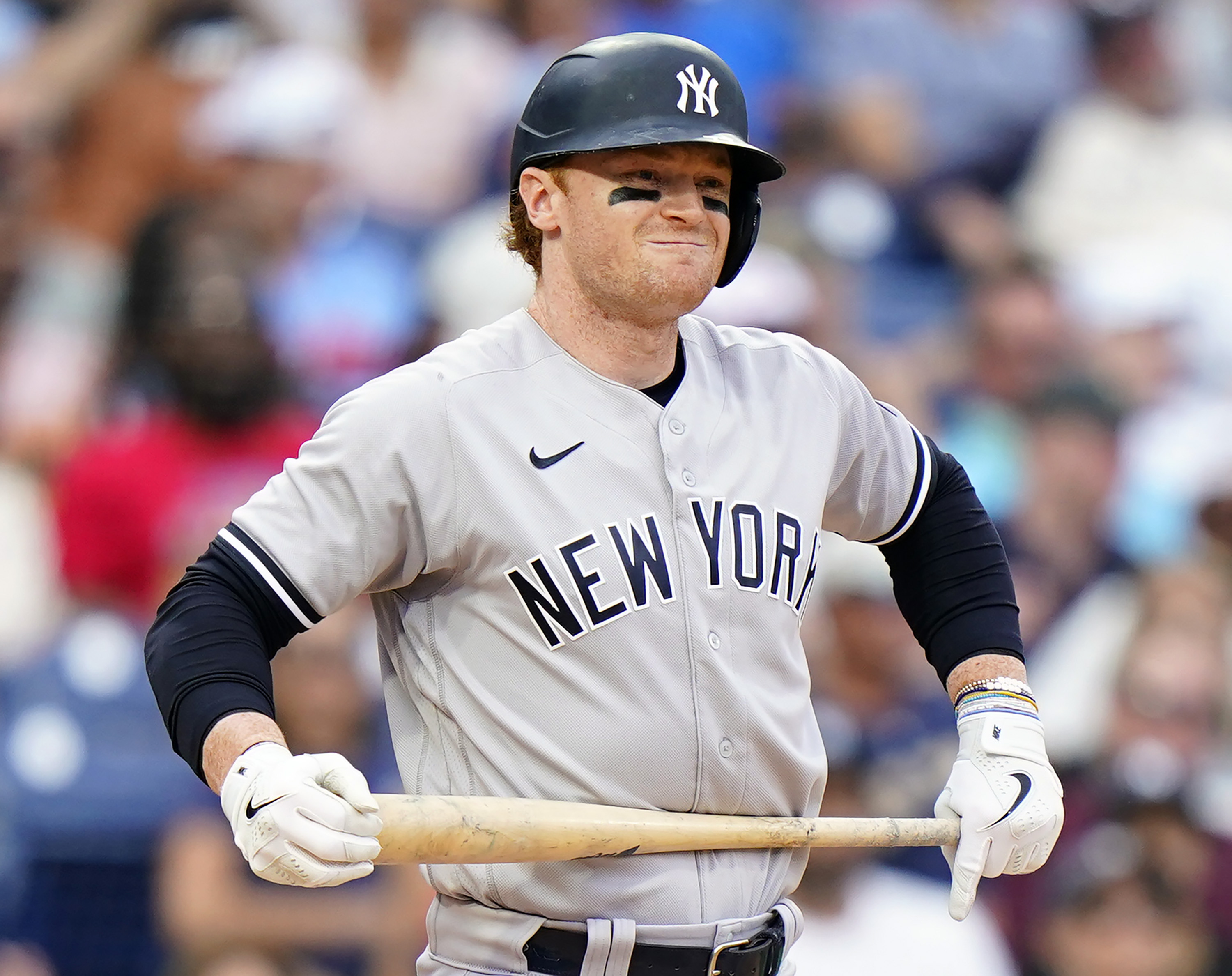 Yankees not certain Clint Frazier will play again amid vision issues 