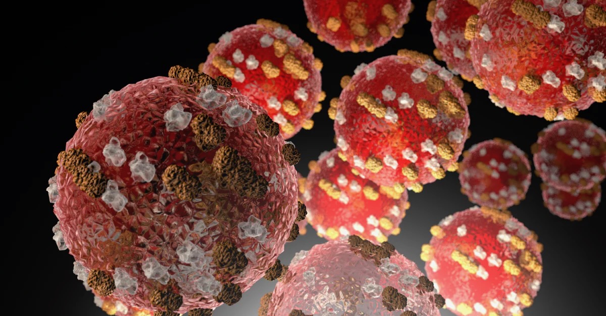 Measles Exposure Reported at 2 Portland-area Restaurants