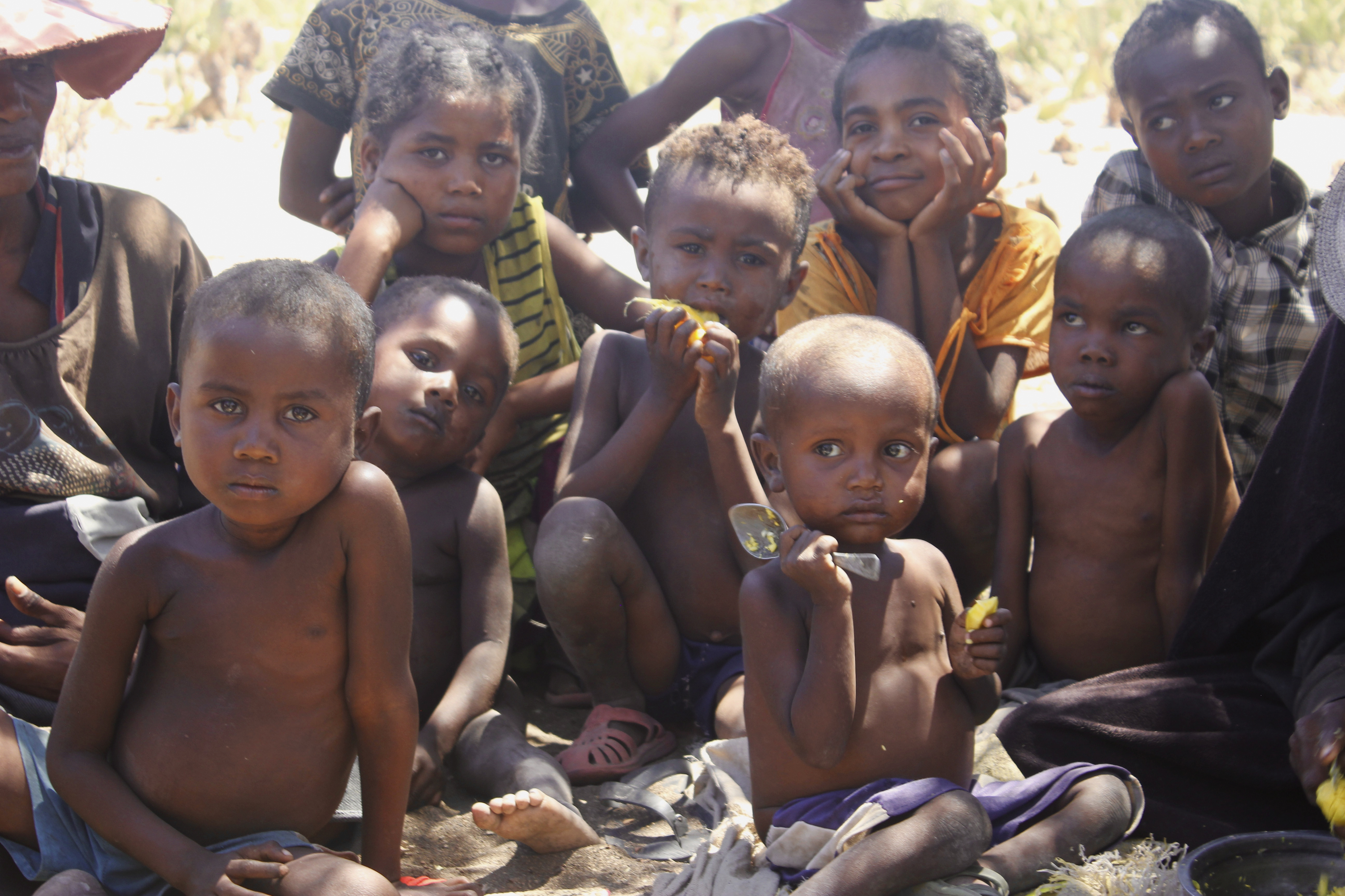 Лицо голода. Голодающие африканские дети.