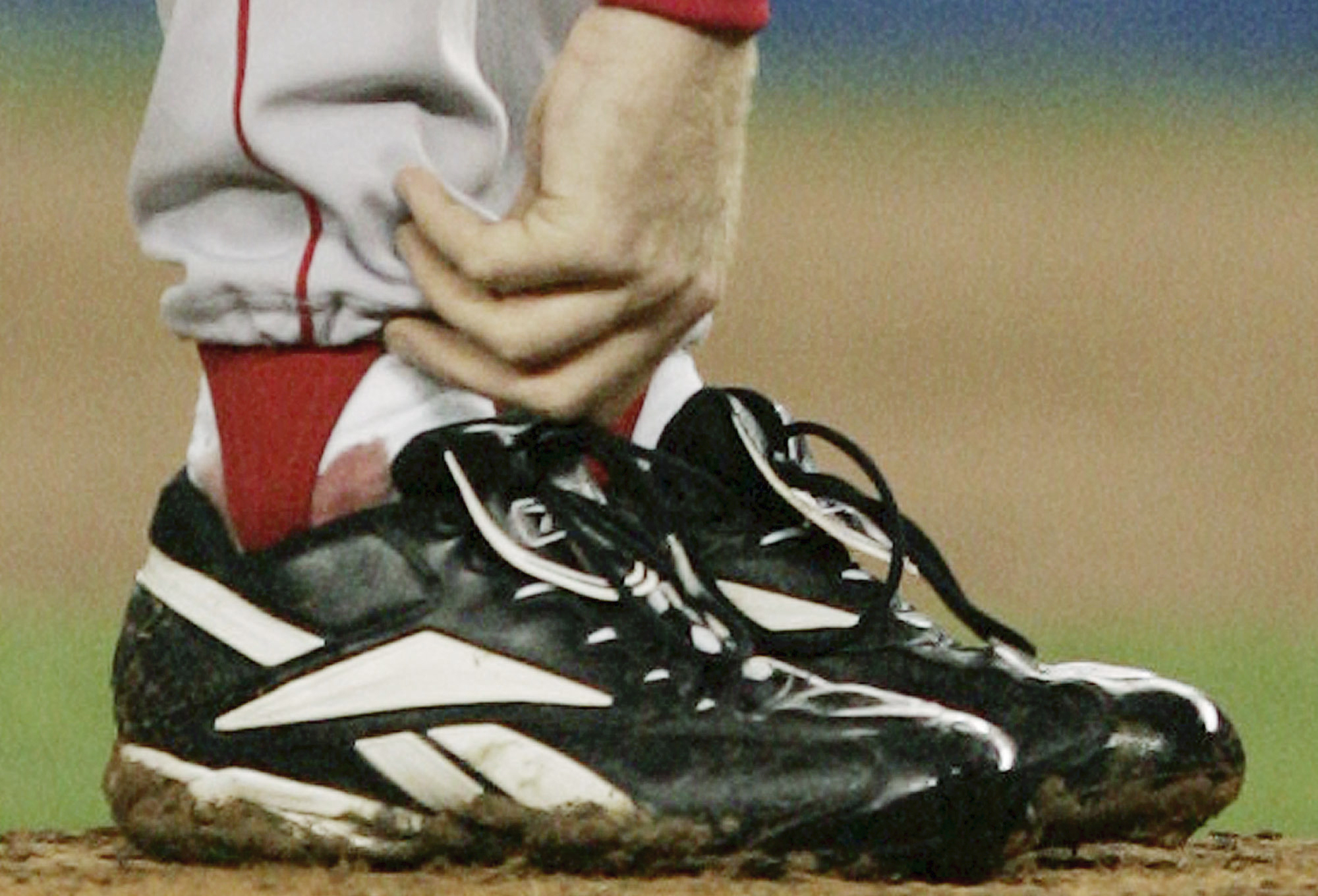 curt schilling ankle