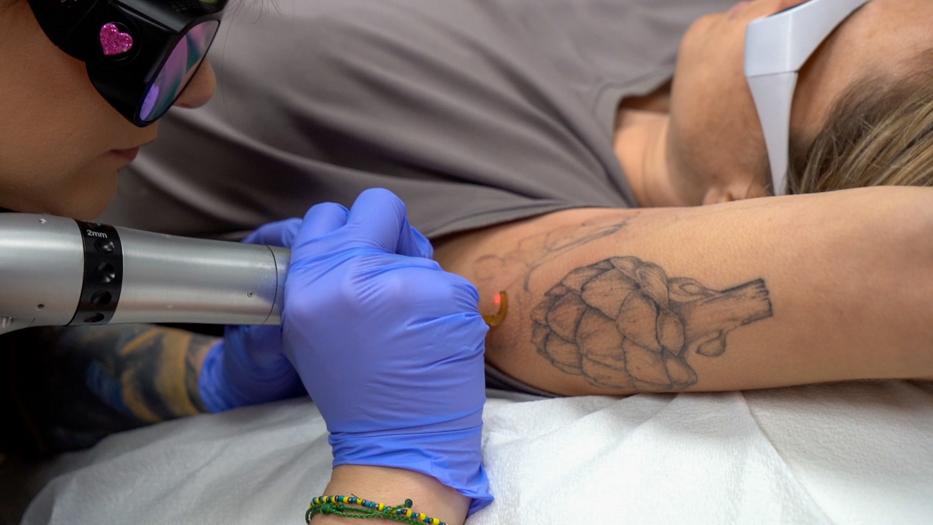 The 7 Clinics for the Best Tattoo Removal in Toronto [2024]