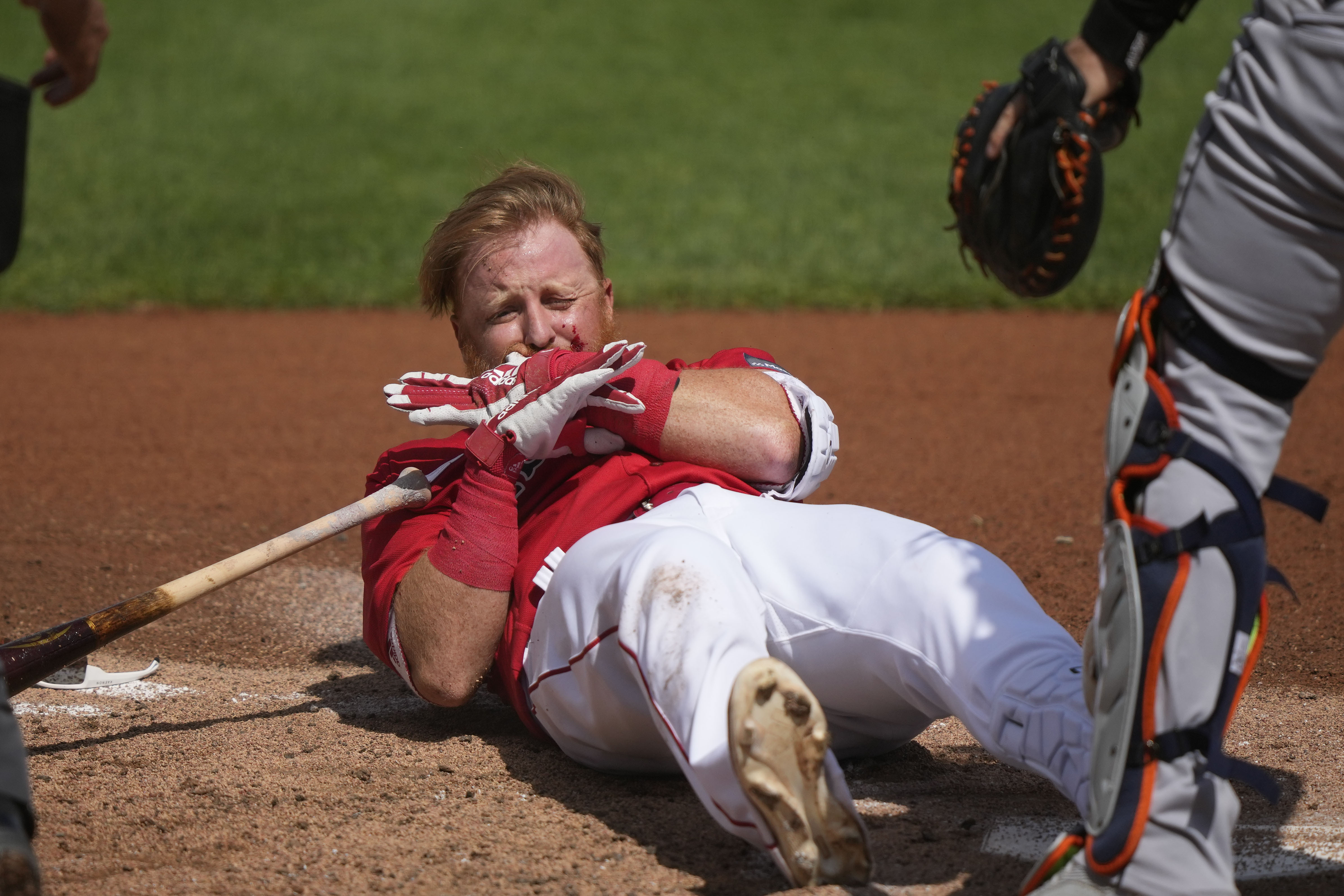 Red Sox spring training: Justin Turner taken to hospital after scary HBP