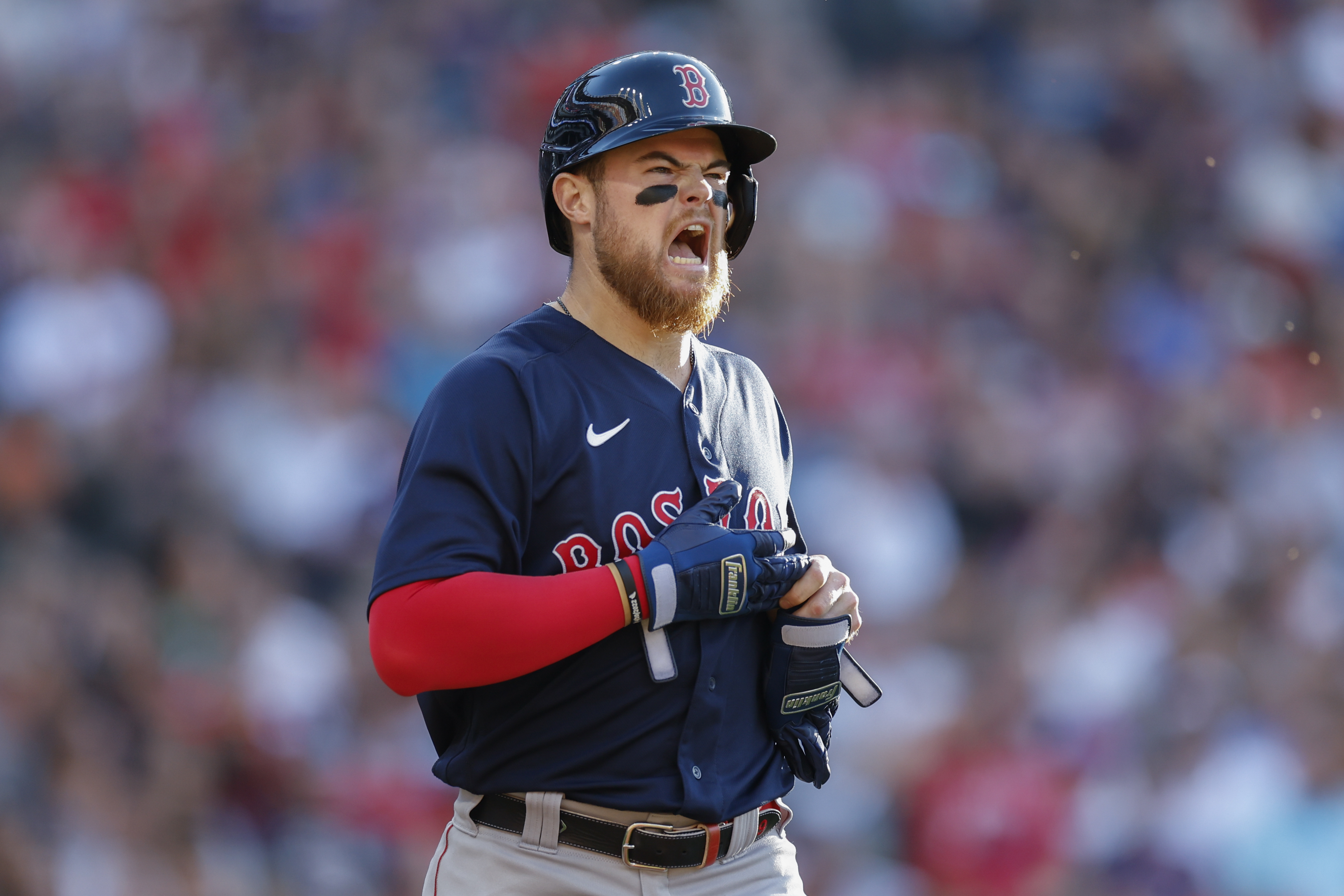 Trevor Story injury: Boston Red Sox second baseman leaves game with right  hand contusion after being hit with pitch 
