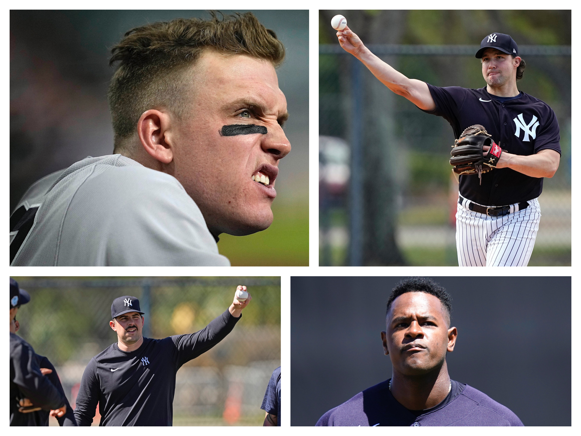 NY Yankees news: Carlos Rodon injury and Luis Severino struggles