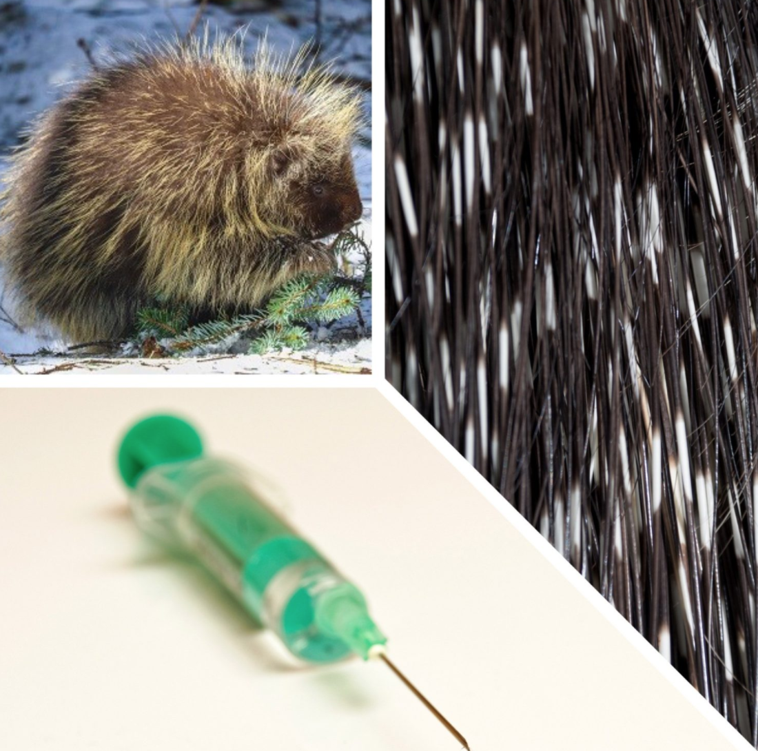 Could Porcupine Quills Help Us Design the Next Hypodermic Needle?, Science