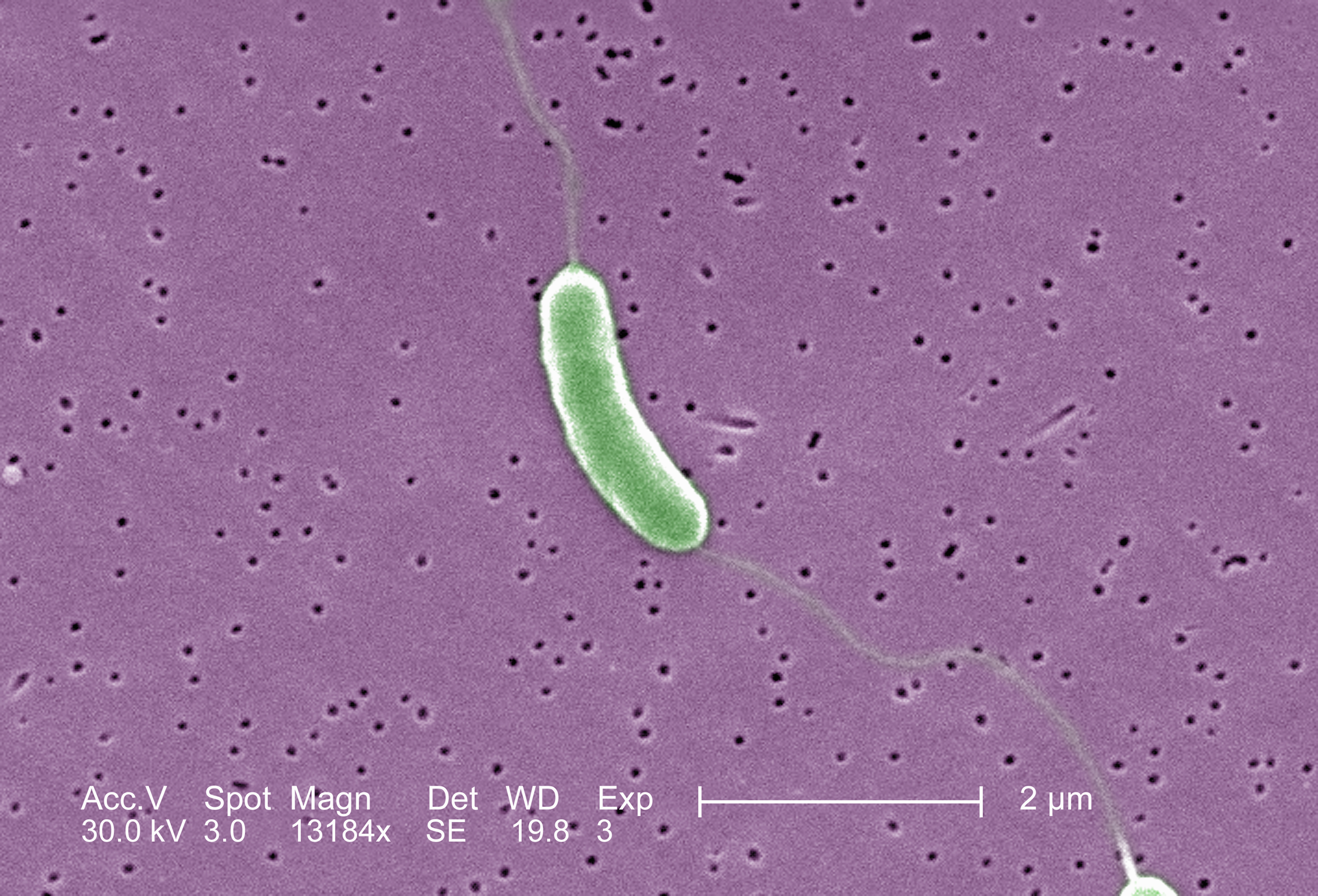 Il CDC emette un avviso sanitario nazionale sui batteri carnivori