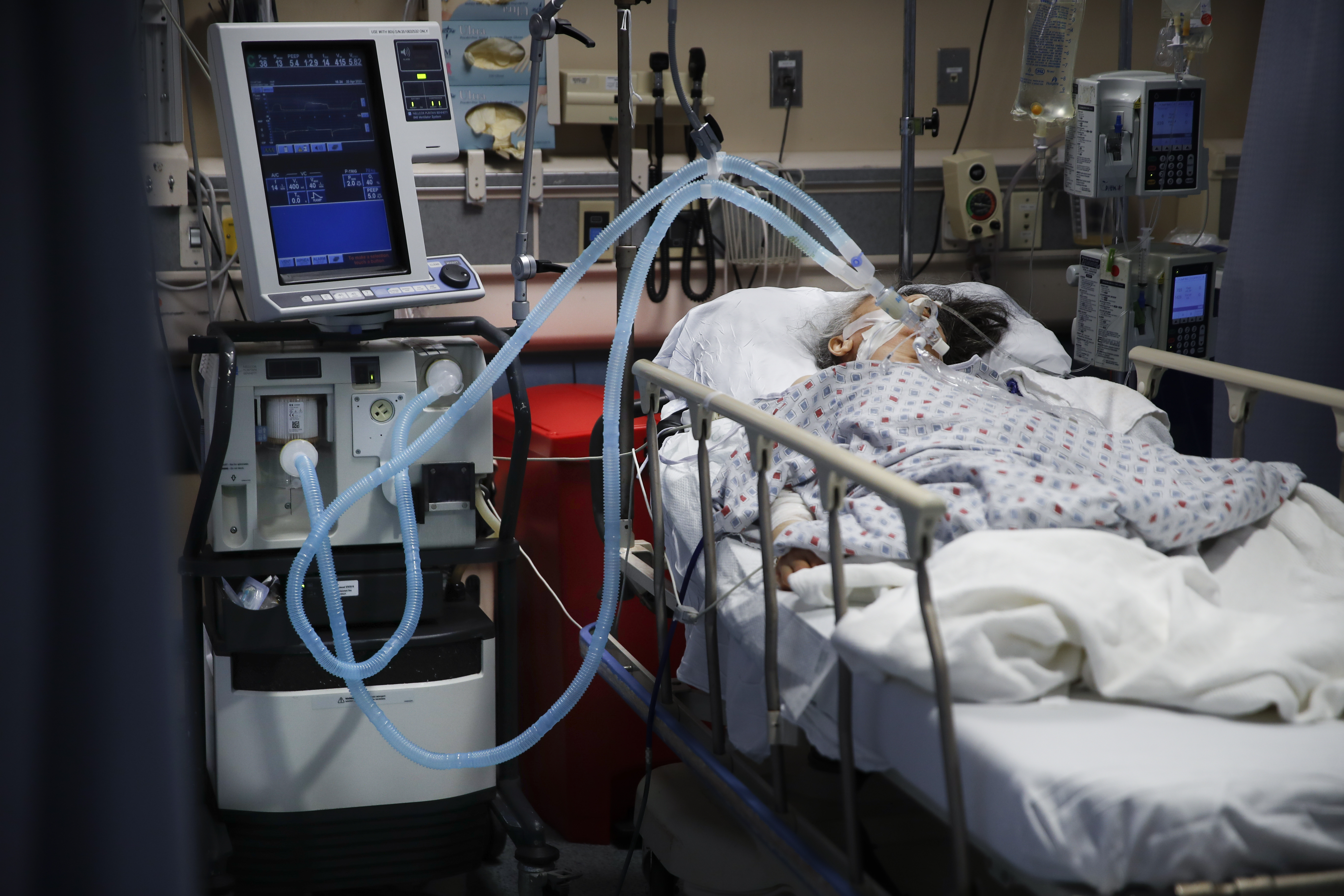 Study: 88% of coronavirus patients on ventilators died in NY