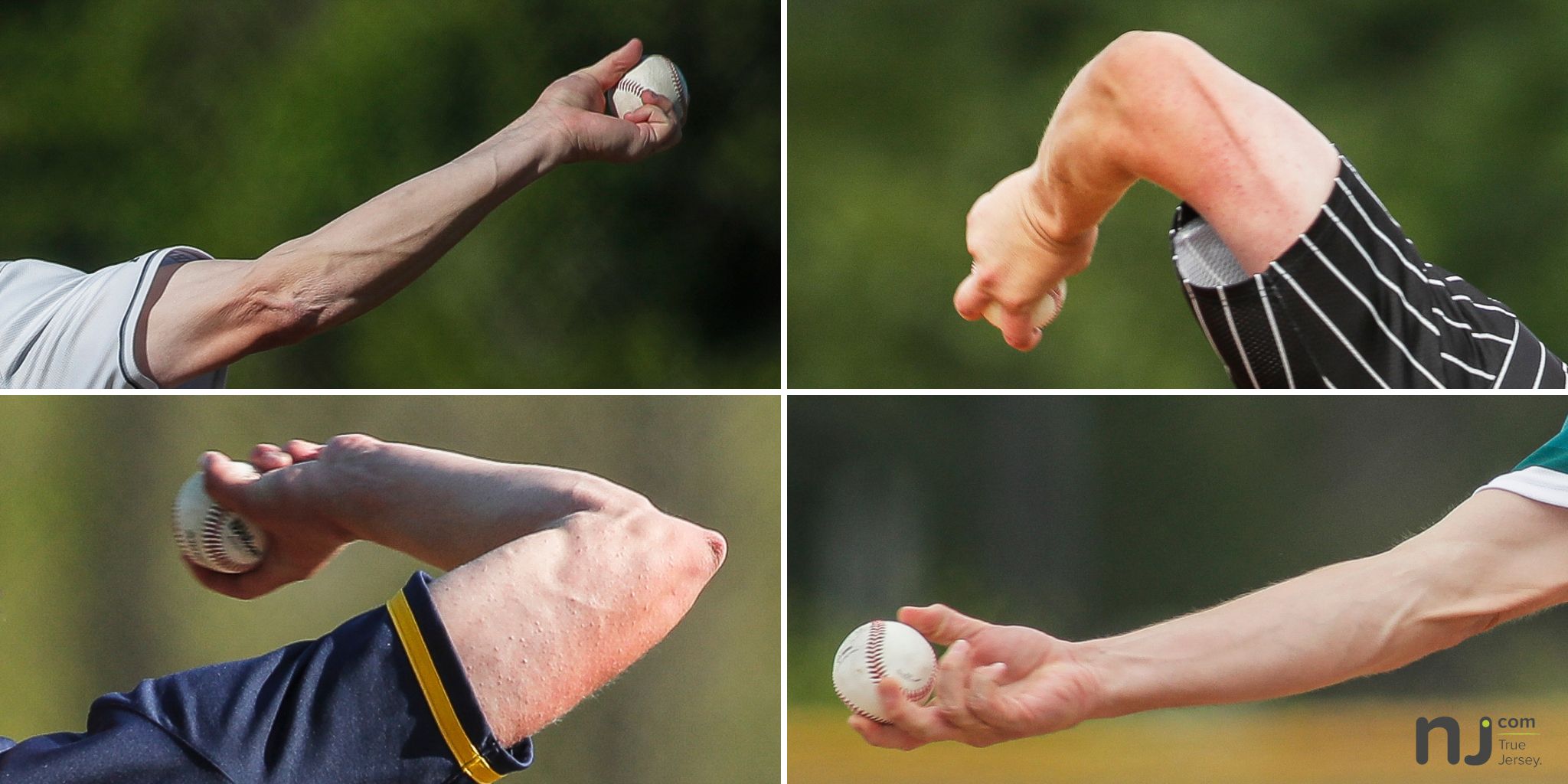 Throwing injuries in young baseball players: Is there something we are not  considering?