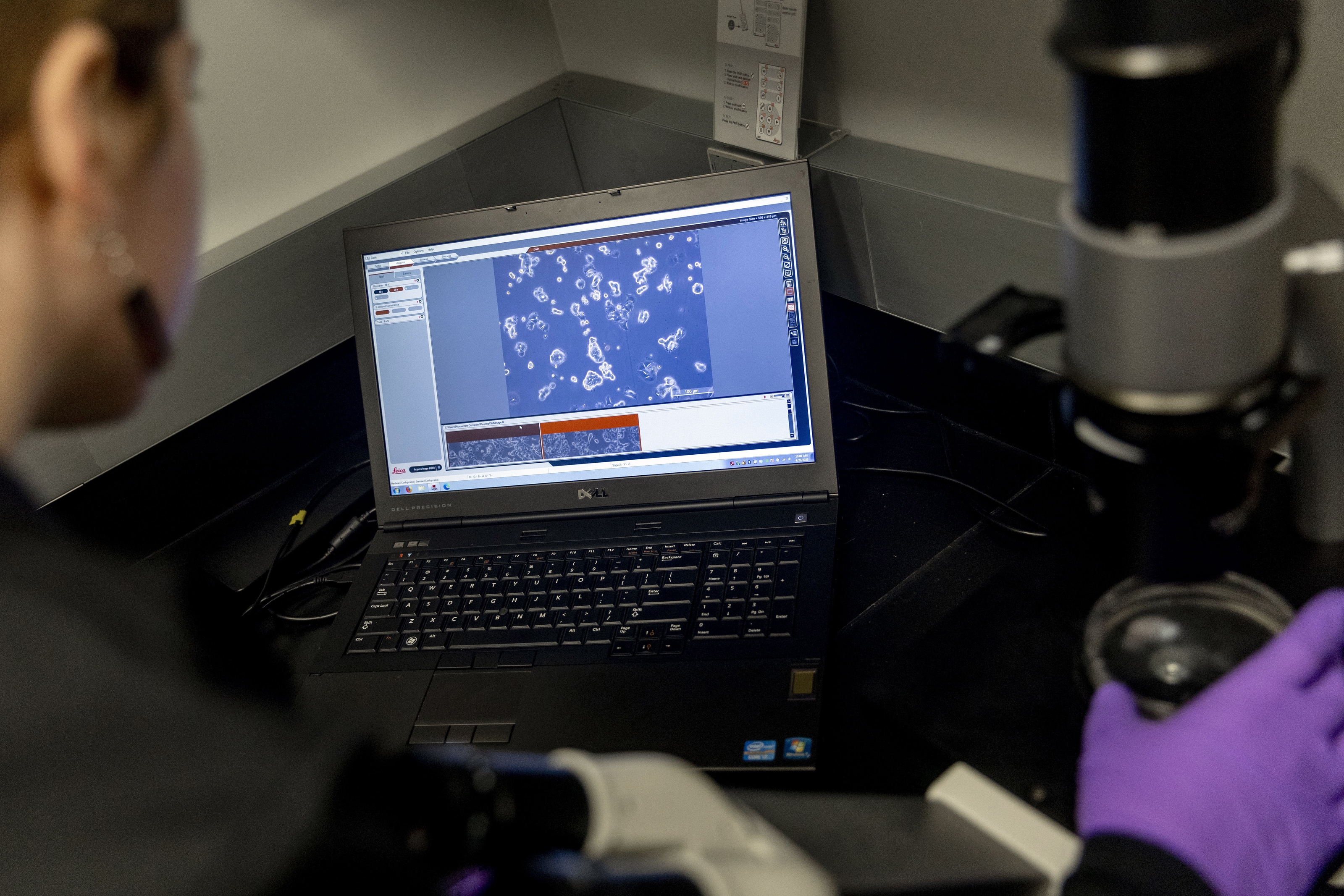 Federal funding cuts a threat to slowing MSU cancer treatment research ...