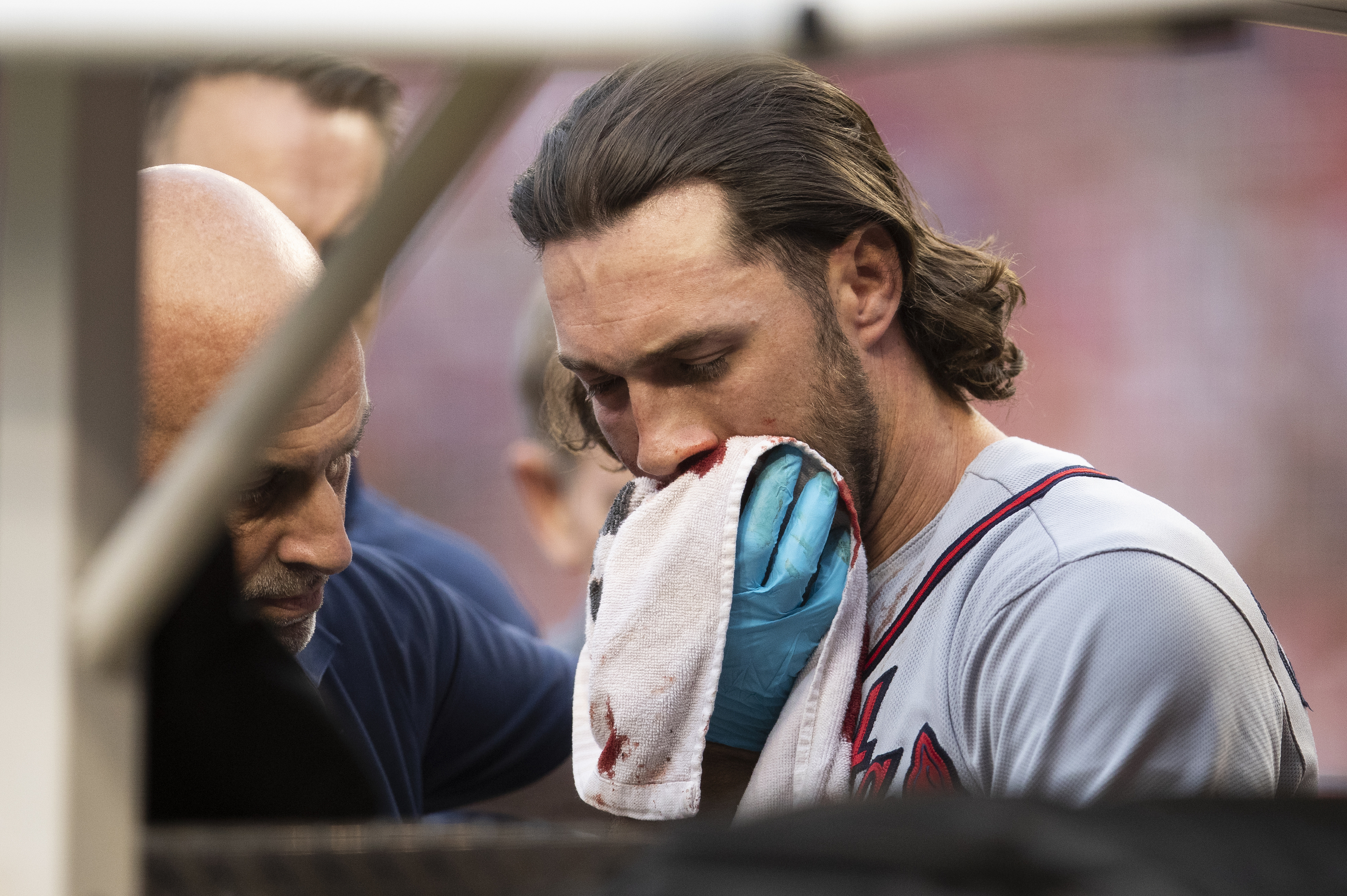 Culberson out for remainder of season with multiple facial fractures