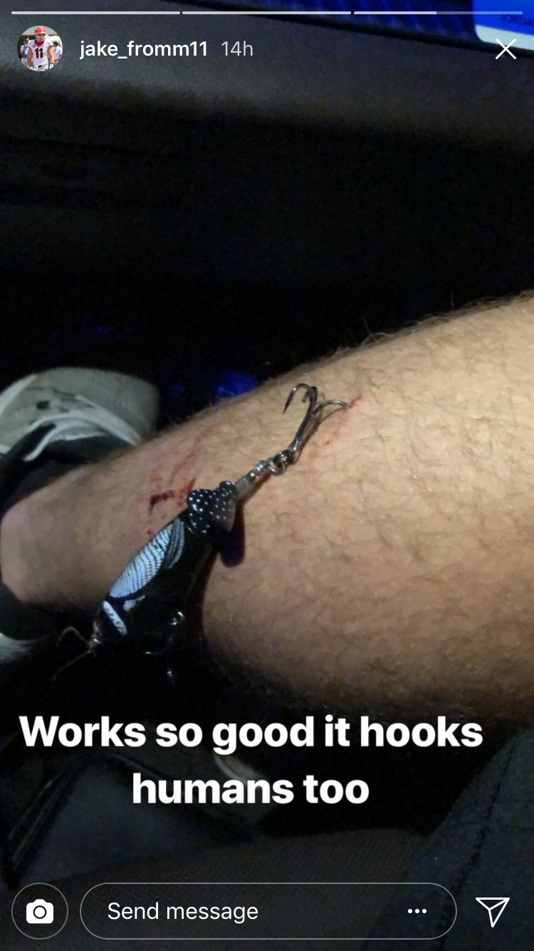 Jake Fromm, Georgia quarterback, has fishing lure stuck in his leg after  accident