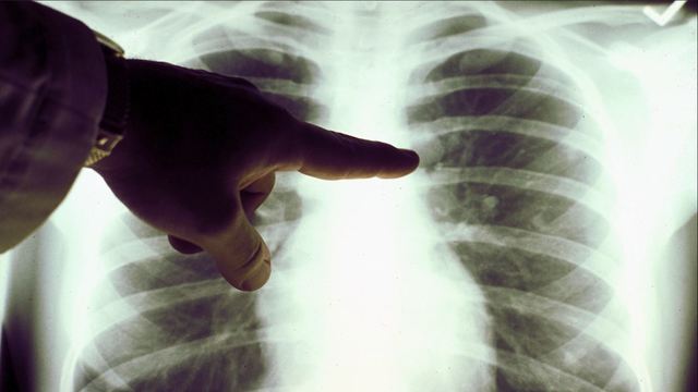 <p>The downtown Atlanta Sheraton Hotel where three people possibly caught Legionnaires' disease. The Georgia Department of Health closed the hotel until further notice.</p> <p> </p>