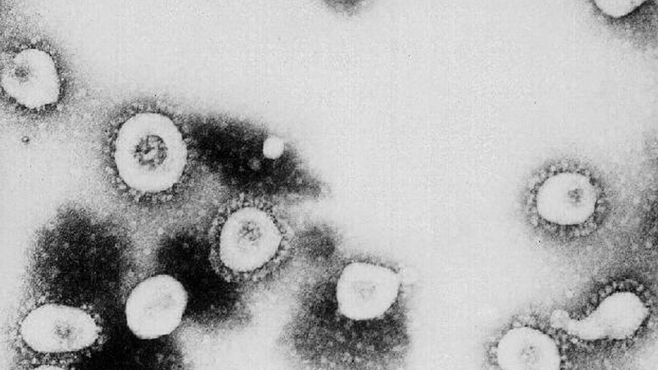 This undated handout photo from the Centers for Disease Control and Prevention (CDC) shows a microscopic view of the Coronavirus at the CDC in Atlanta, Georgia.