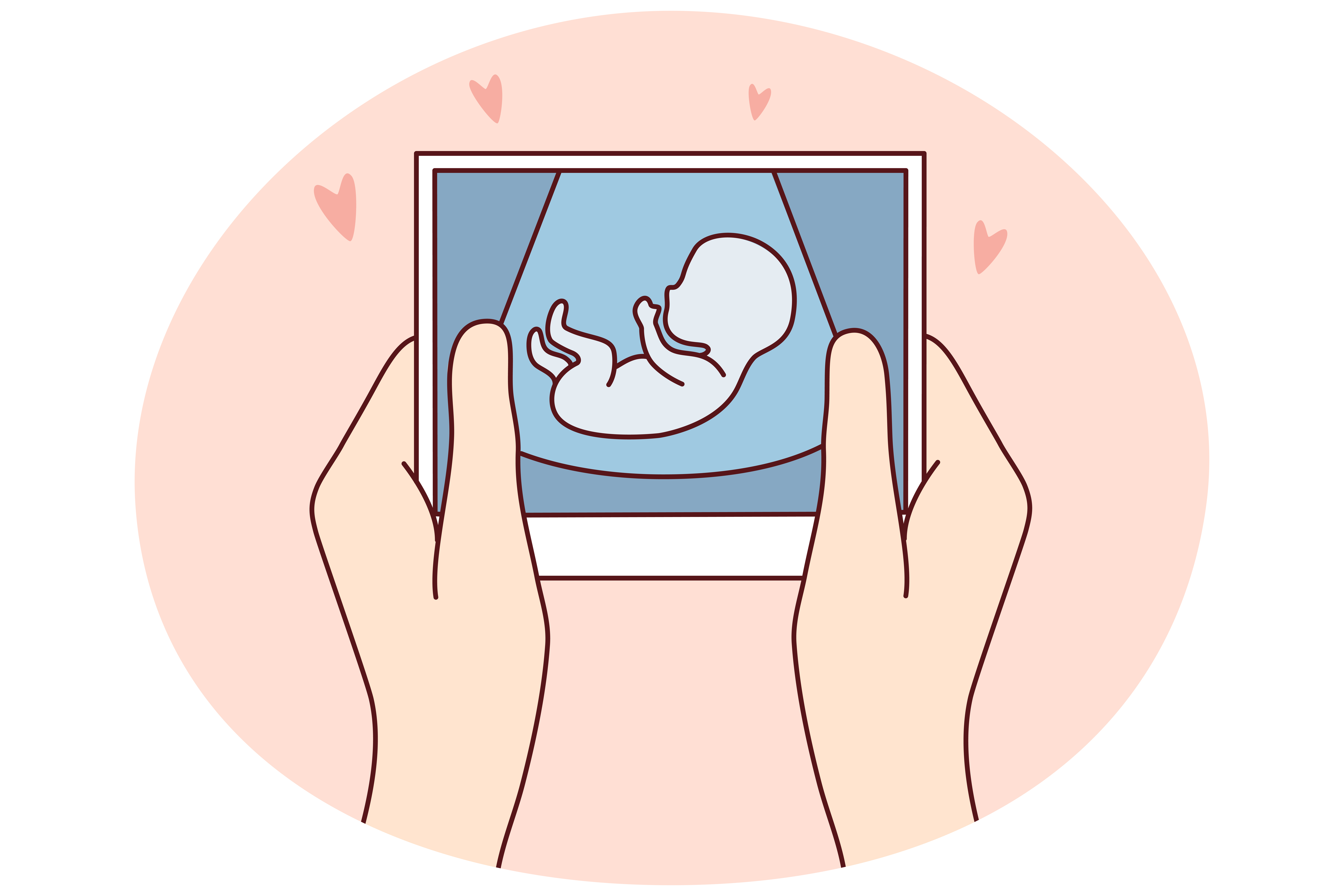 Looking for infertility coverage in FEHB plans? Read the fine print.