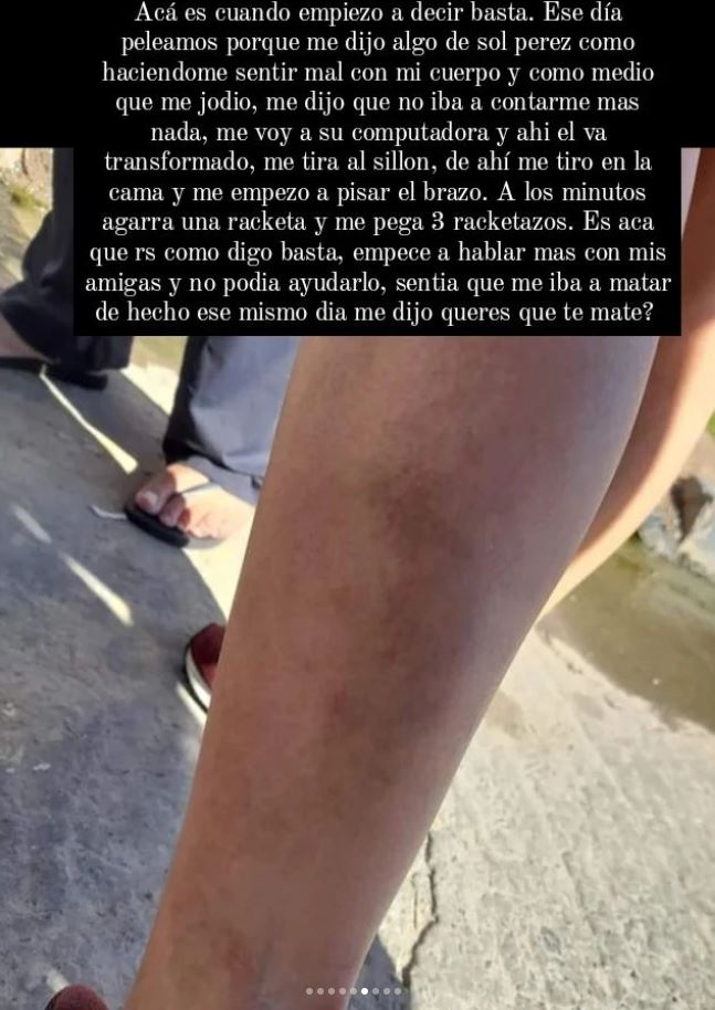 Pasé mi ubicación por si terminaba muerta”: el calvario de una víctima de  violencia de género | TN