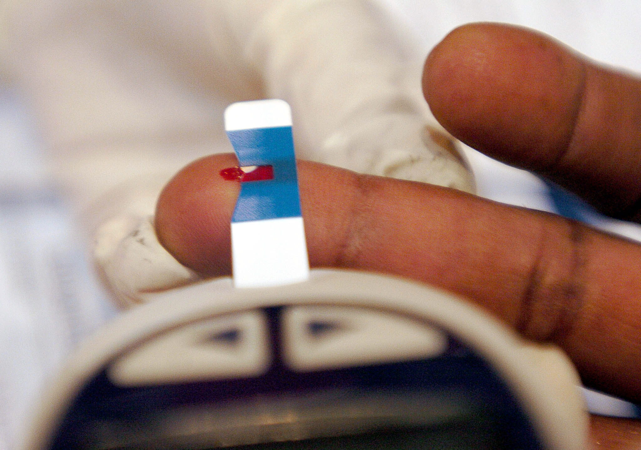 El páncreas artificial se pondrá a prueba en 1.000 personas con diabetes. (Foto: EFE)