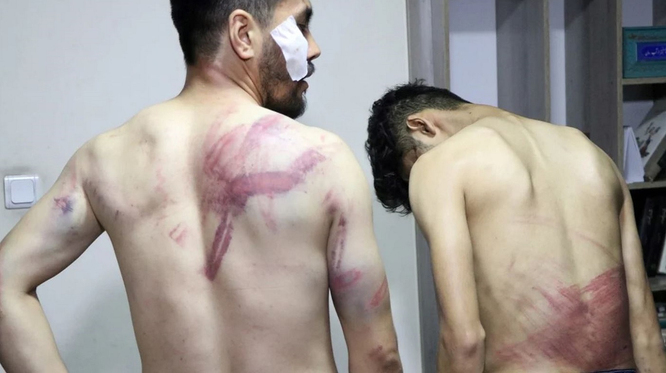 Los periodistas golpeados en Kabul. (Foto: Reuters)