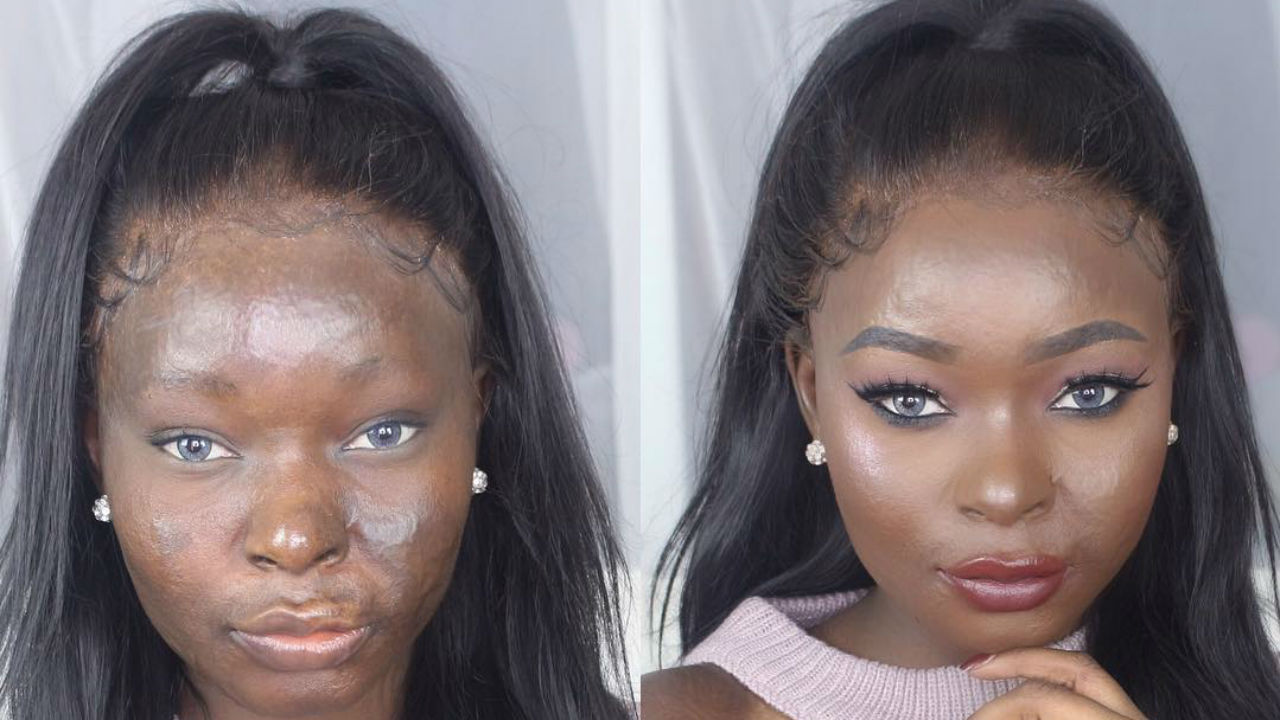 Joven con la cara quemada revoluciona Youtube con sus tutoriales de  maquillaje | TN
