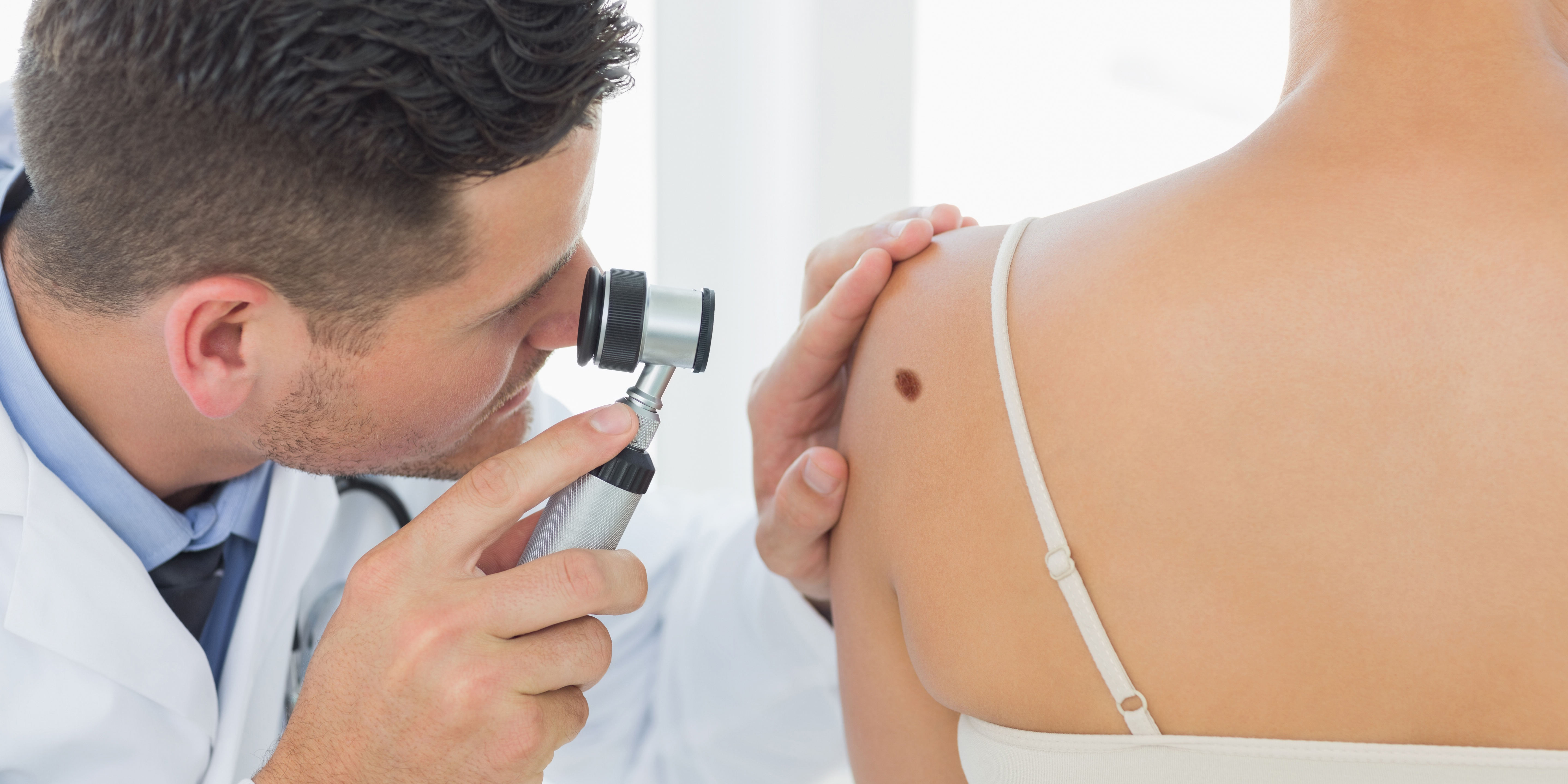 Первая стадия меланомы кожи