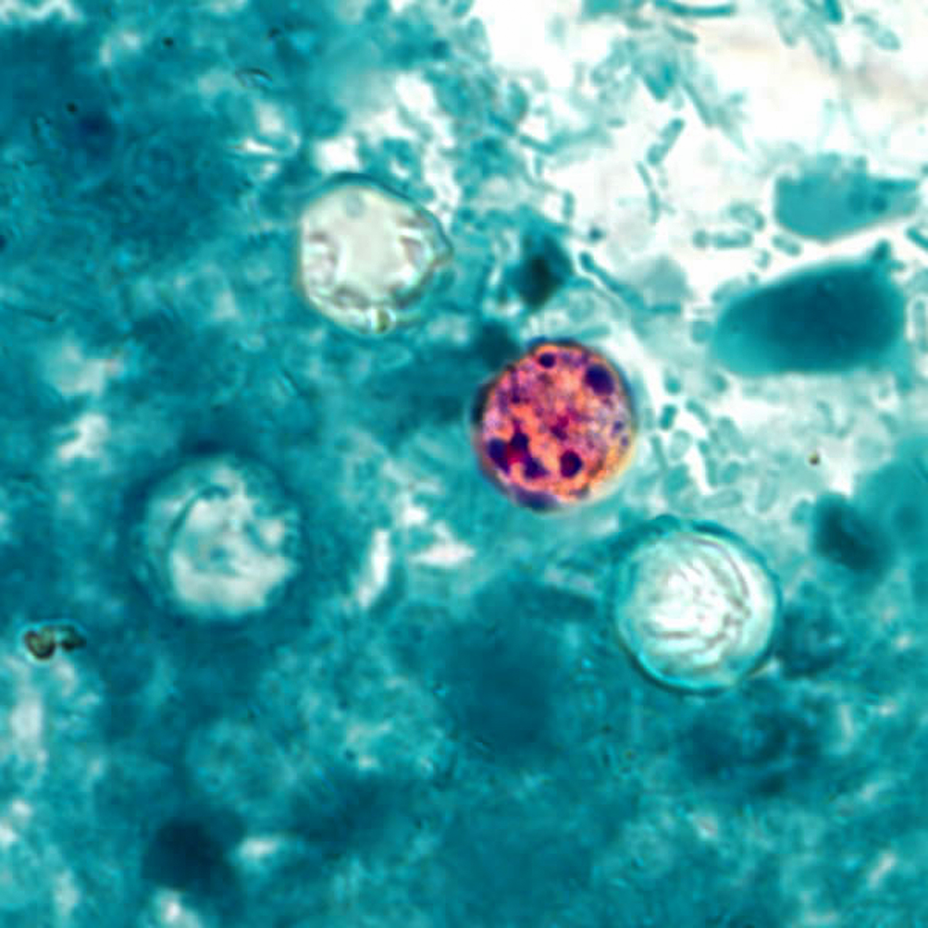 What to know about cyclosporiasis, the food parasite making Marylanders sick