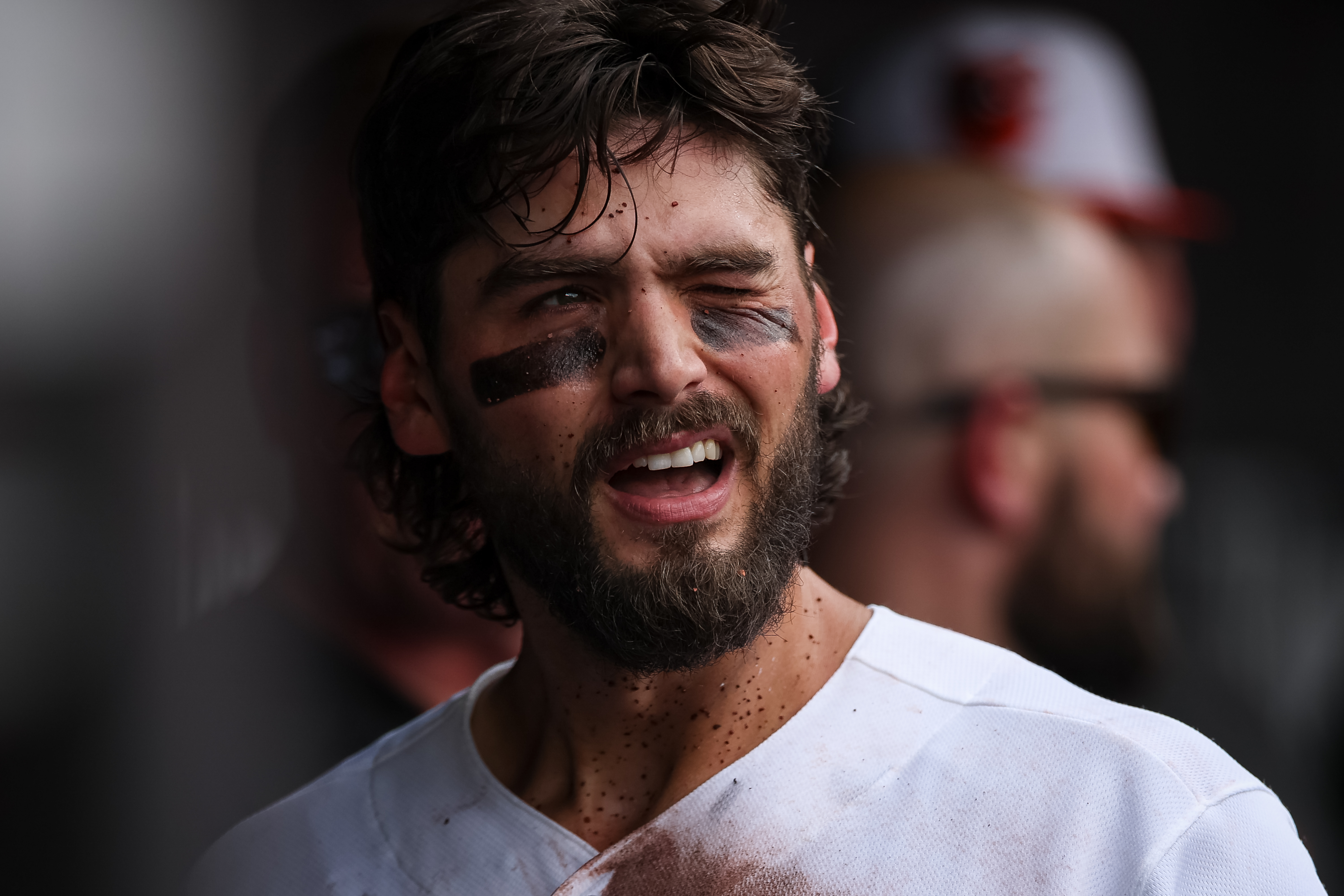 Orioles' Blaze Alexander suffers broken hand in victory over Royals