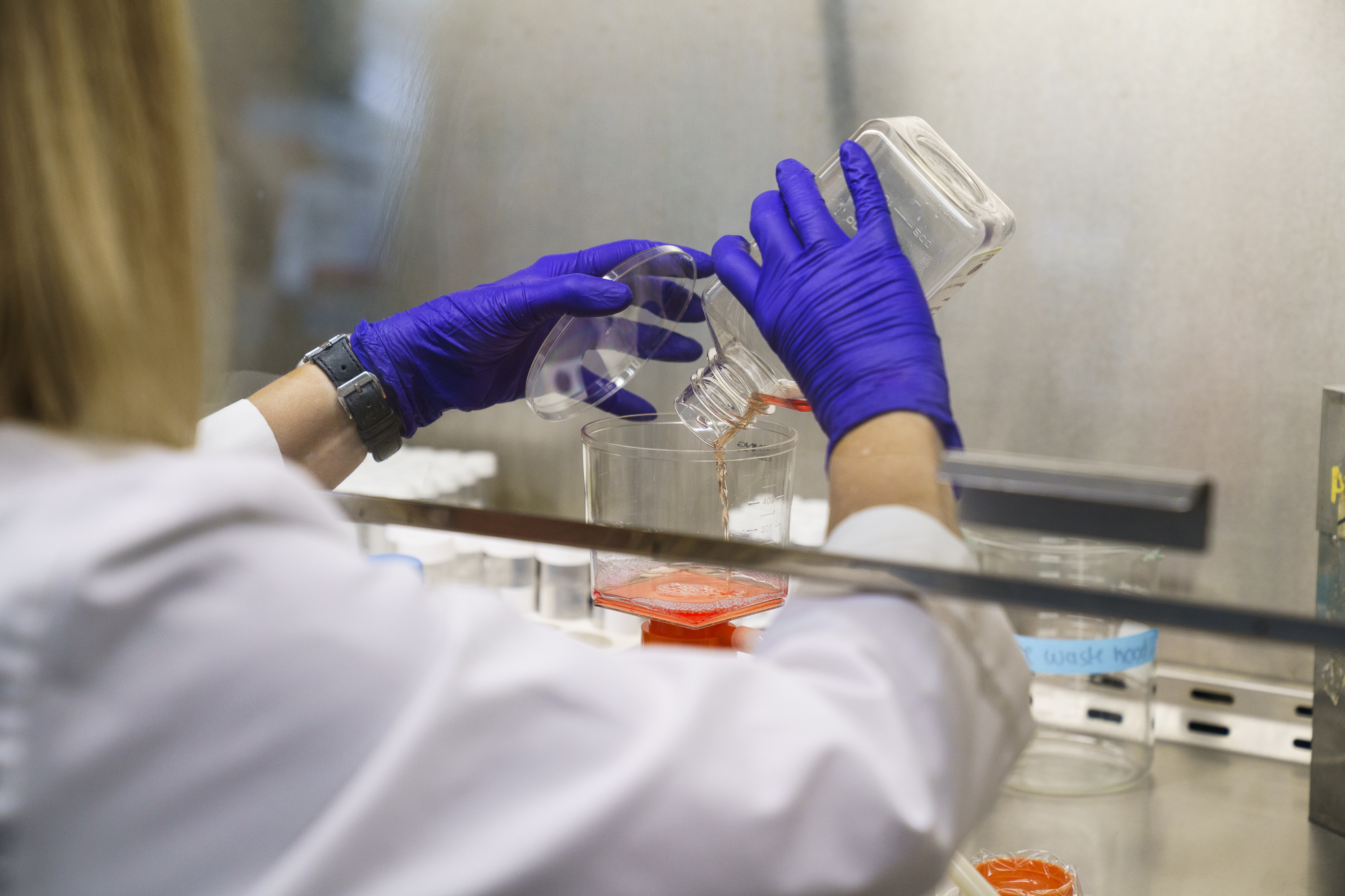Johns Hopkins' funding squeeze isn't over — and it's threatening lifesaving research