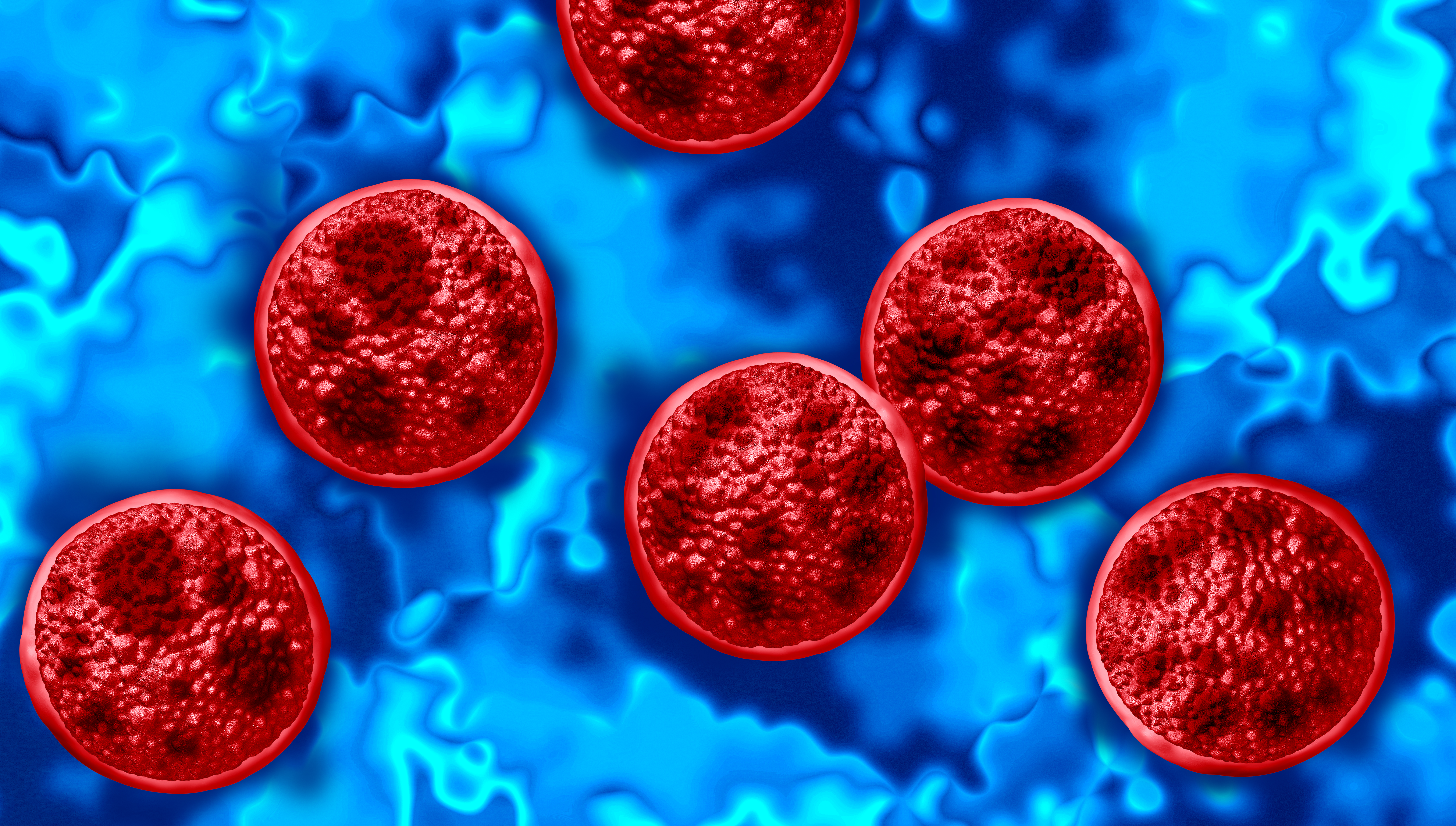 Cyclosporiasis outbreak has affected about 1 in every 1,000 people in Michigan and killed two