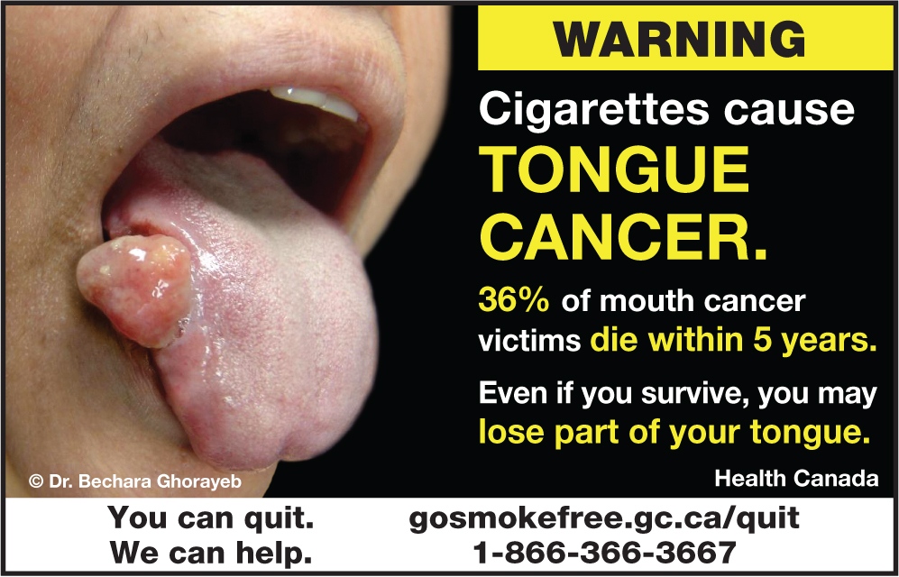 Smoker Hand Holding Cigarette Near Smokefilled Lungs Showing Health Risk Smoking 265064746