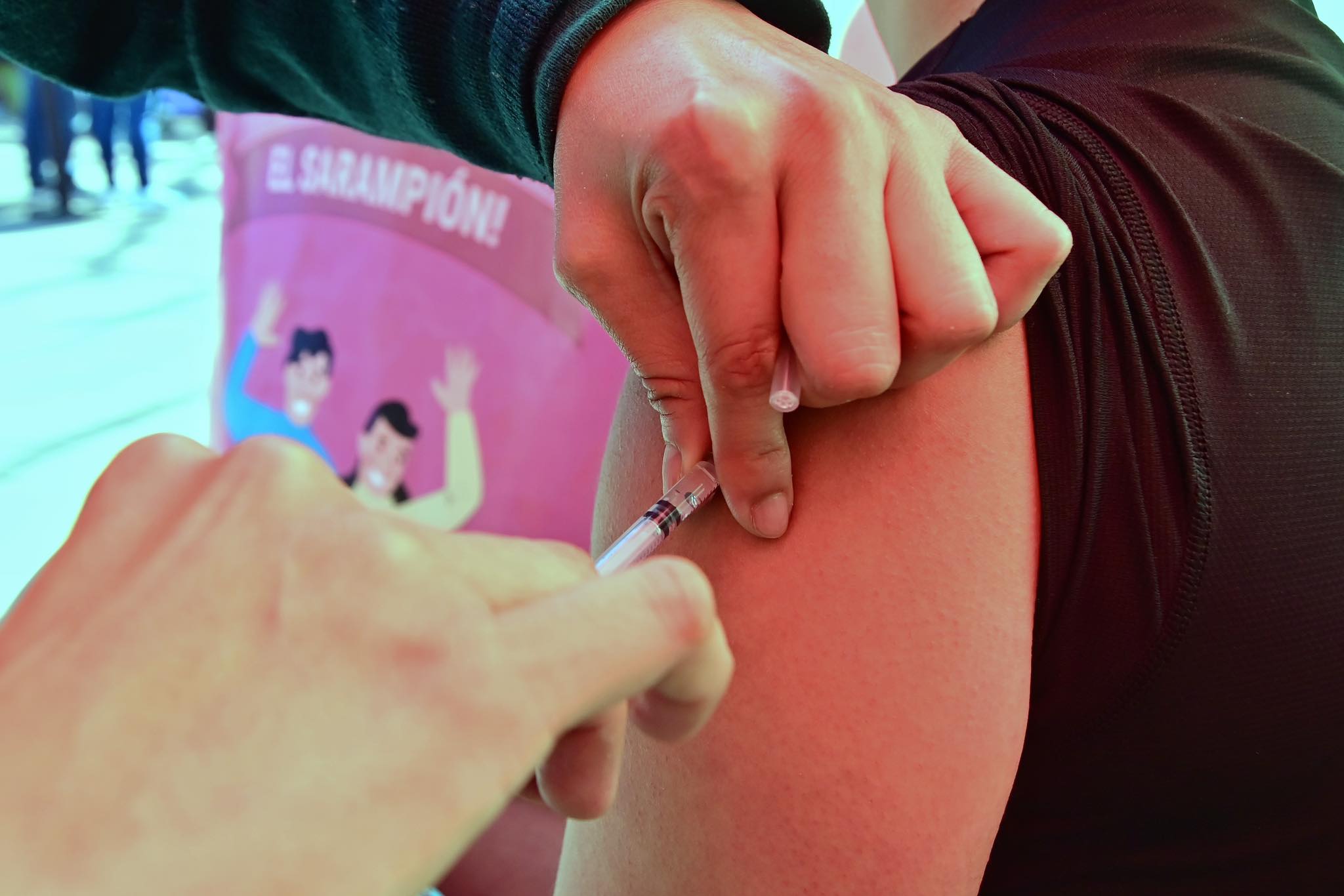 Gobierno de México reporta 28 muertes por brote de sarampión