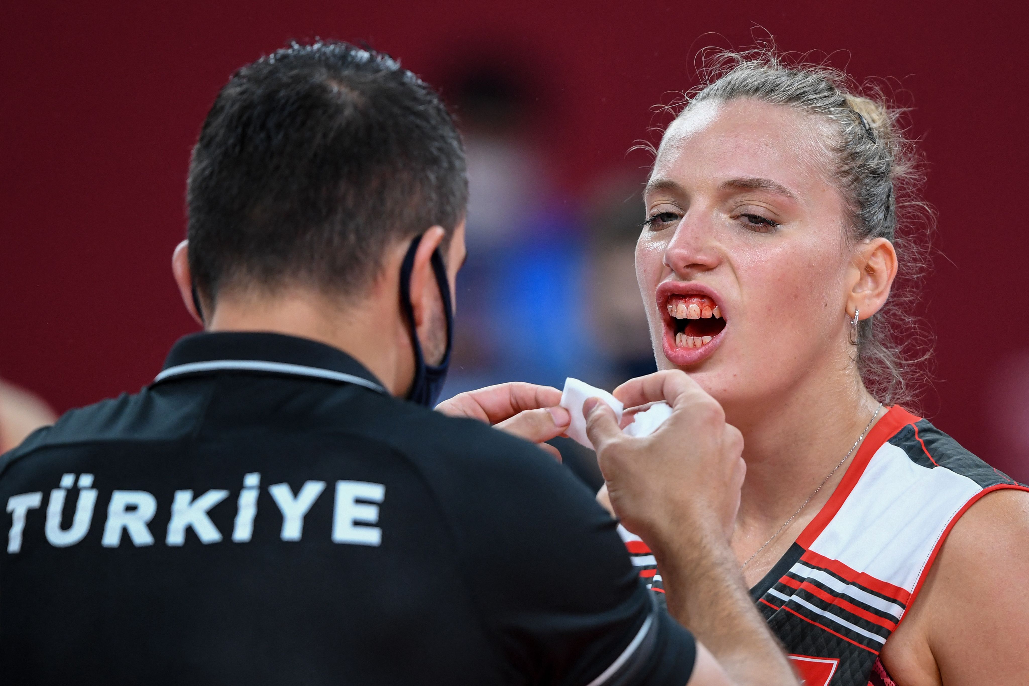 Turkish womens volleyball players power through after an ugly head-to-head collision