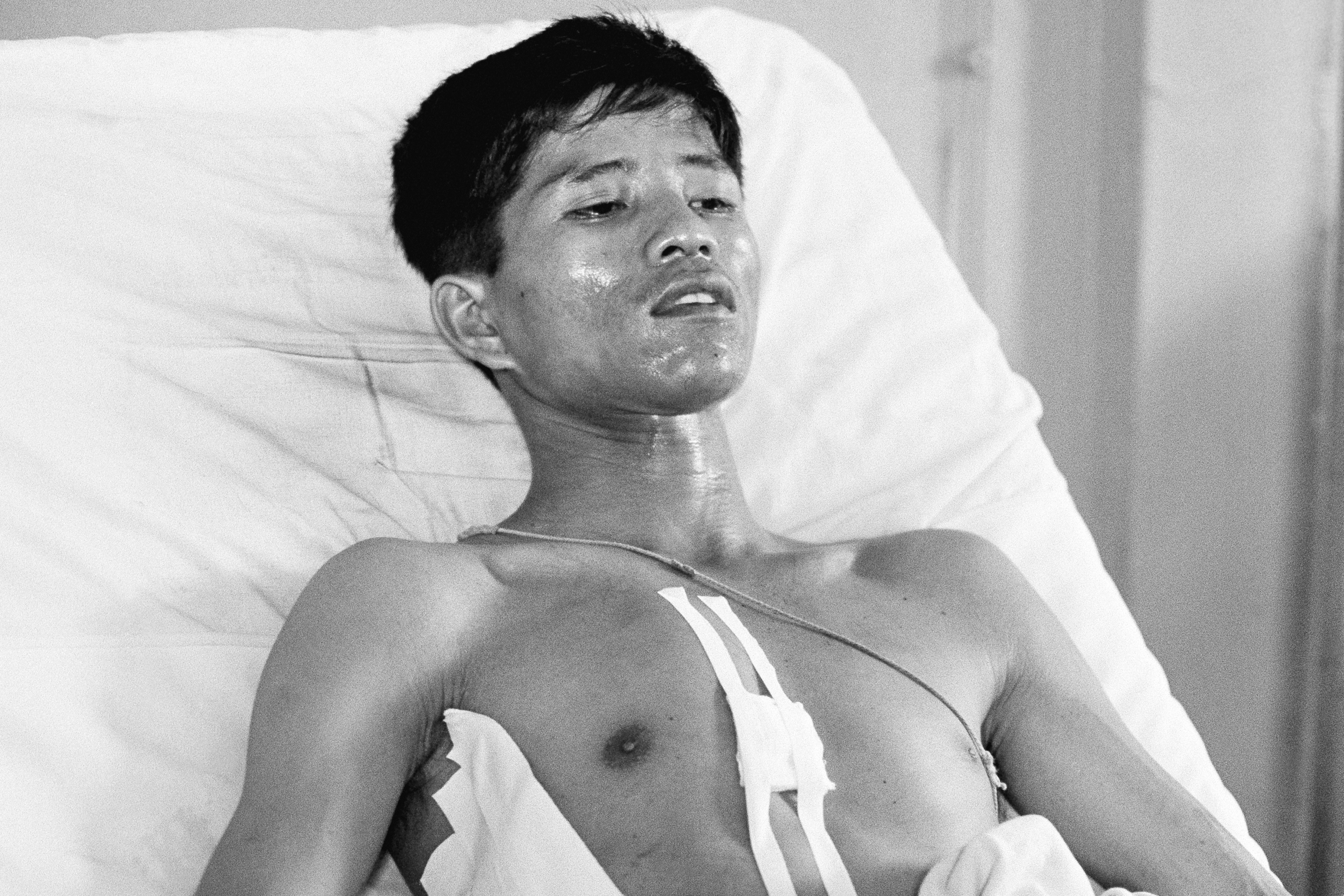 Dang Van Phuoc, combat photographer who lost an eye in the Vietnam