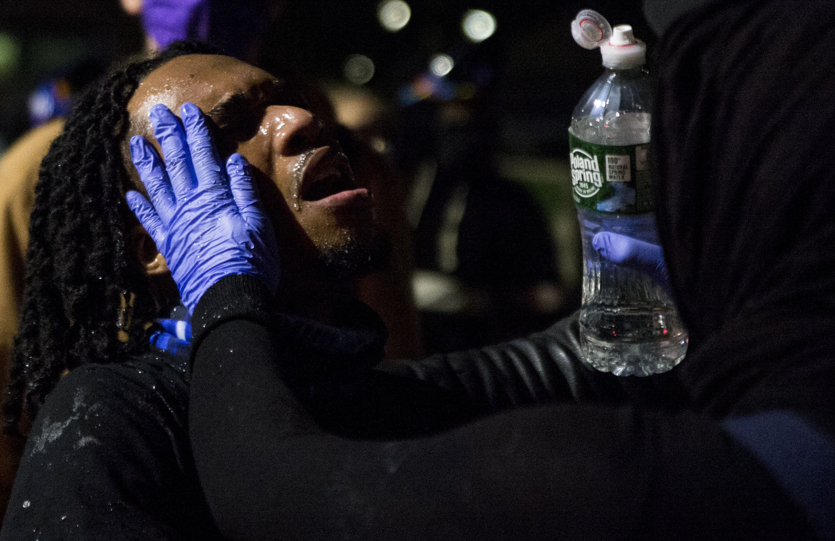 A protester had water poured on his face to help wash away pepper spray.