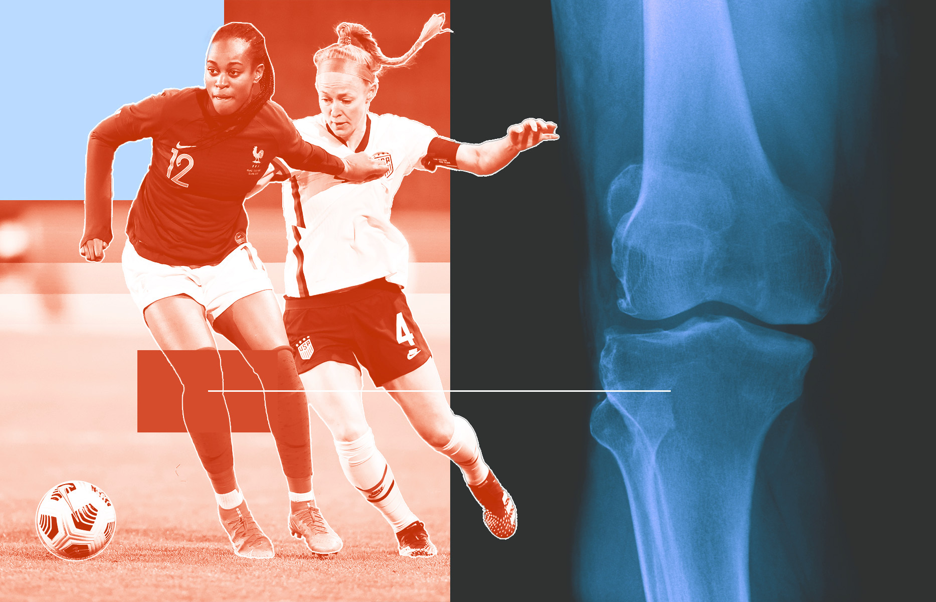 Womens World Cup 2023 ACL injuries plague female athletes