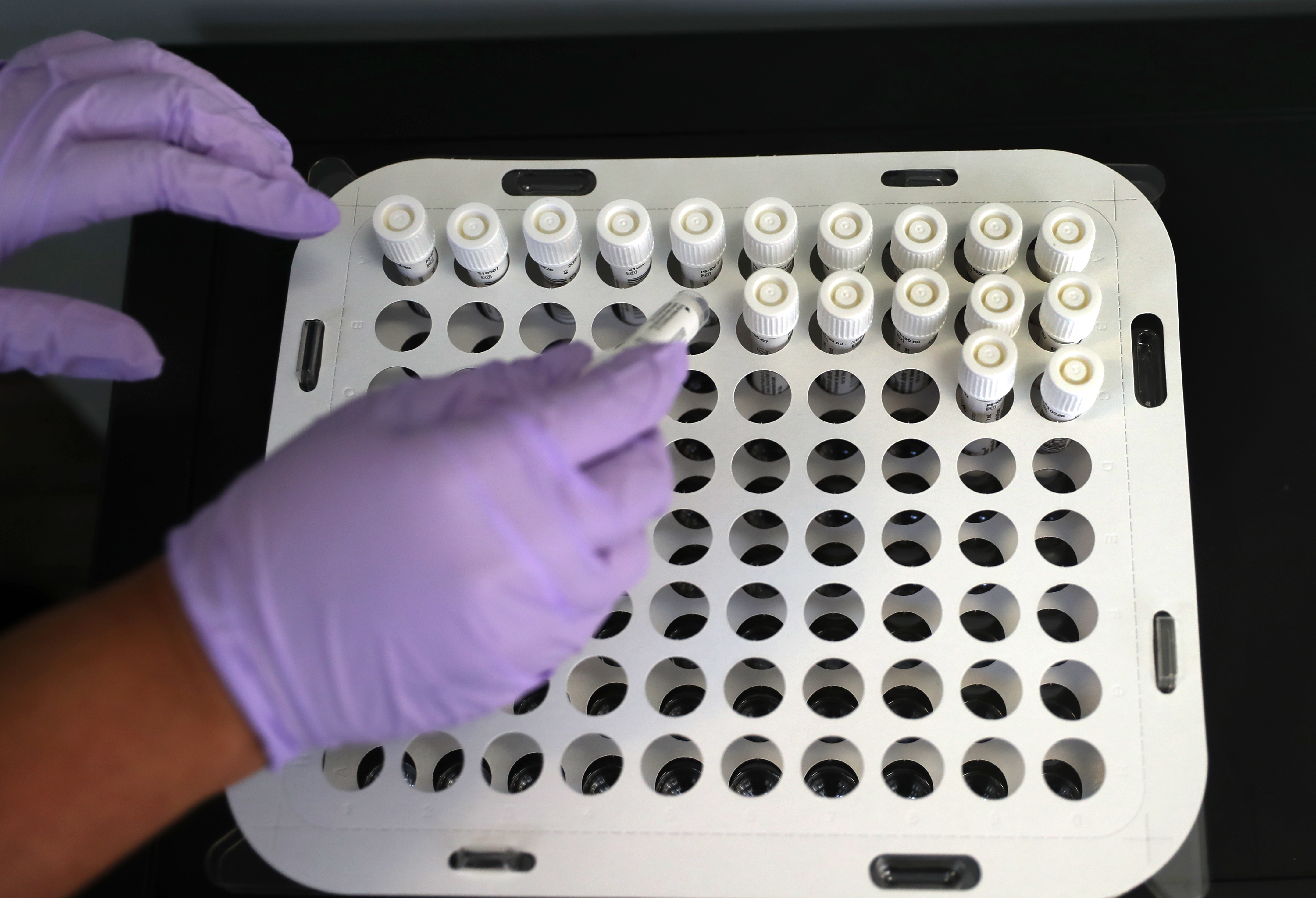 Boston University staff member Maniesse Raza-Ikuinen arranged returned COVID test swabs from students, staff, and others at the university's COVID testing collection kiosk on the campus.