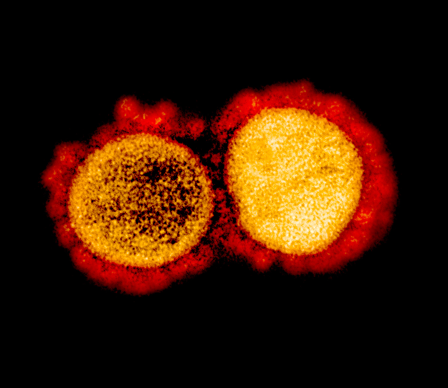 A colored micrograph of the coronavirus, with its distinct protein spikes in red.