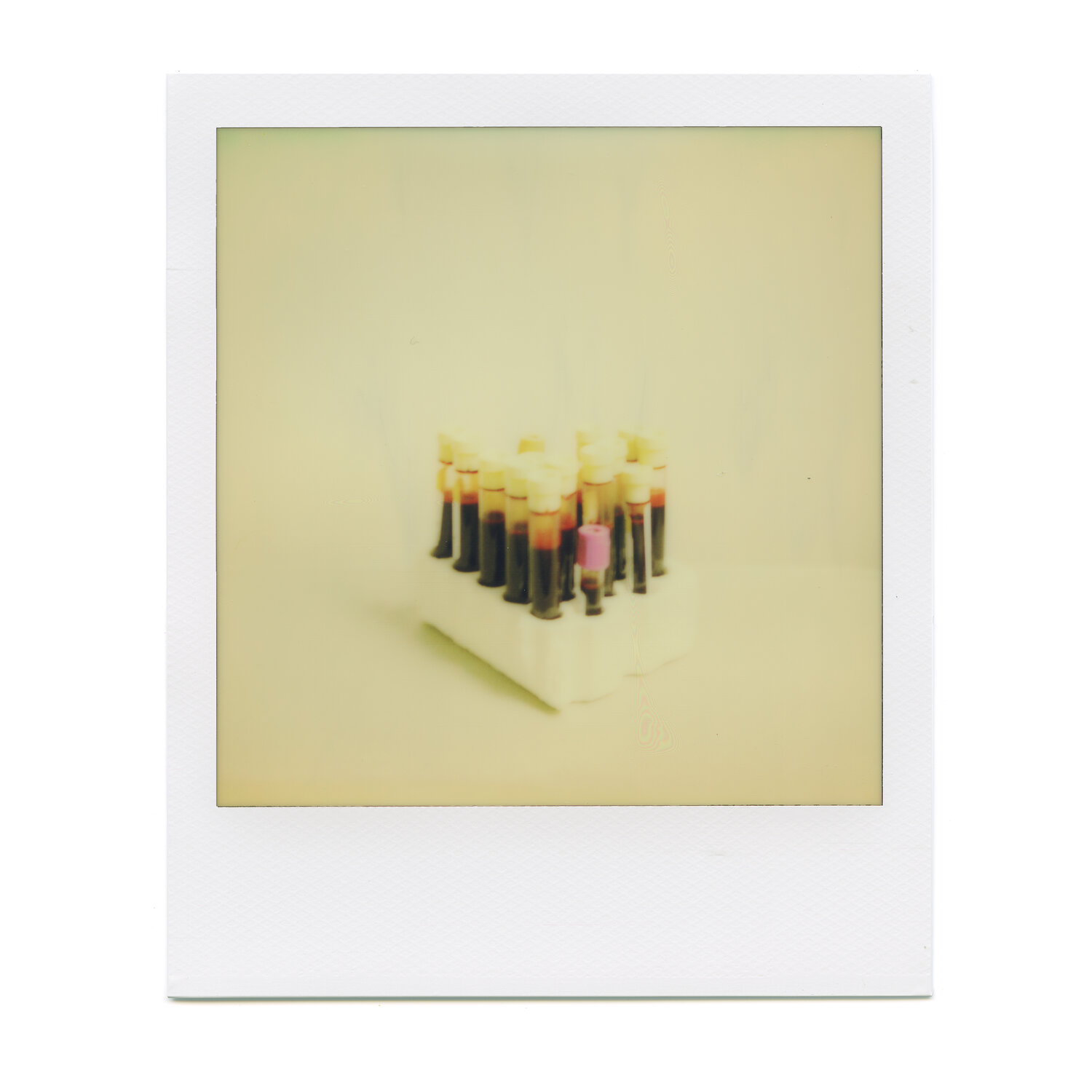 Logan Bellew, "2019 Bloodwork Week 12, I, Viral Load 25290 (Viral Blip)," 2019