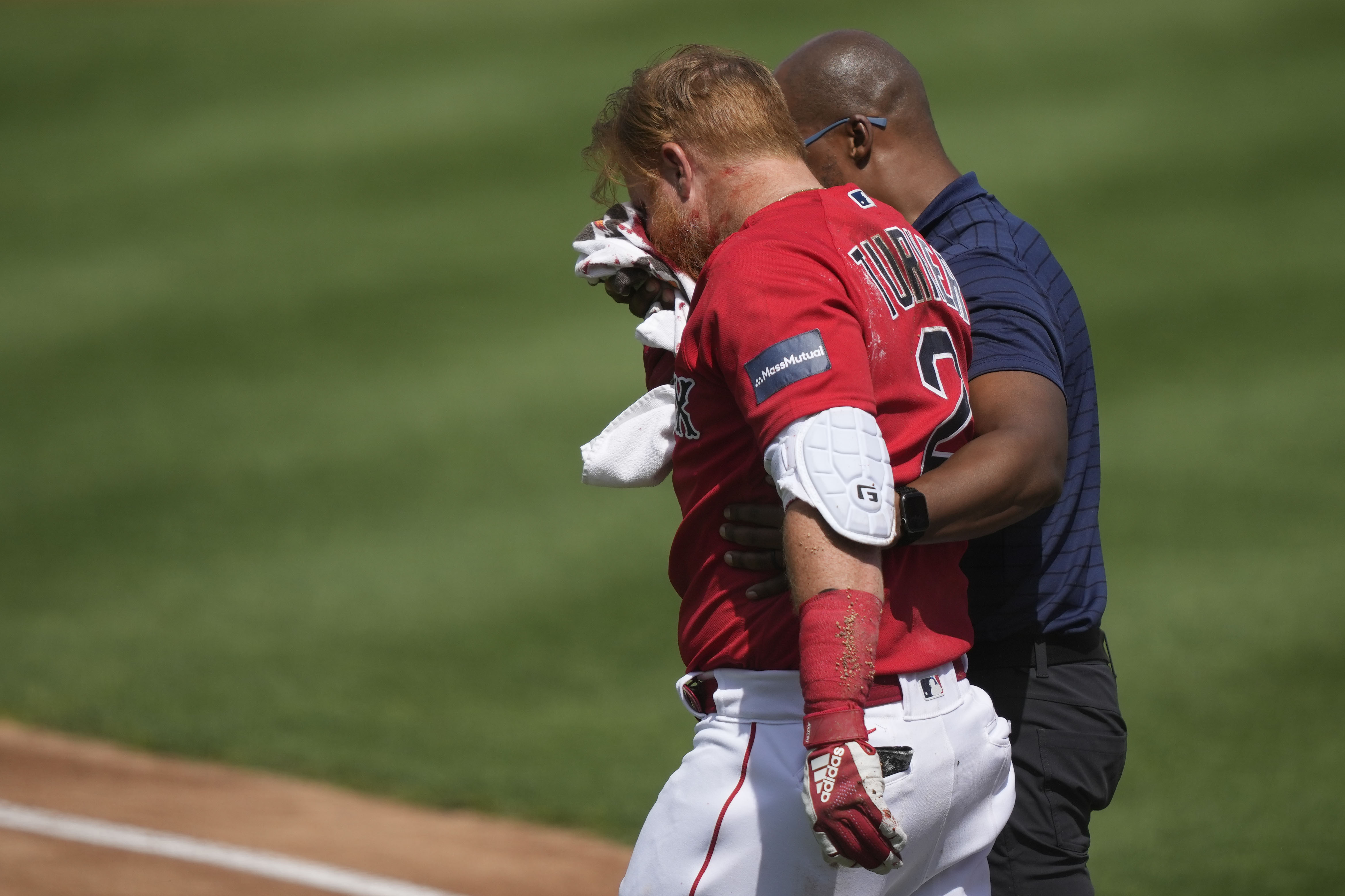 New Red Sox player removed from game after being hit in face with