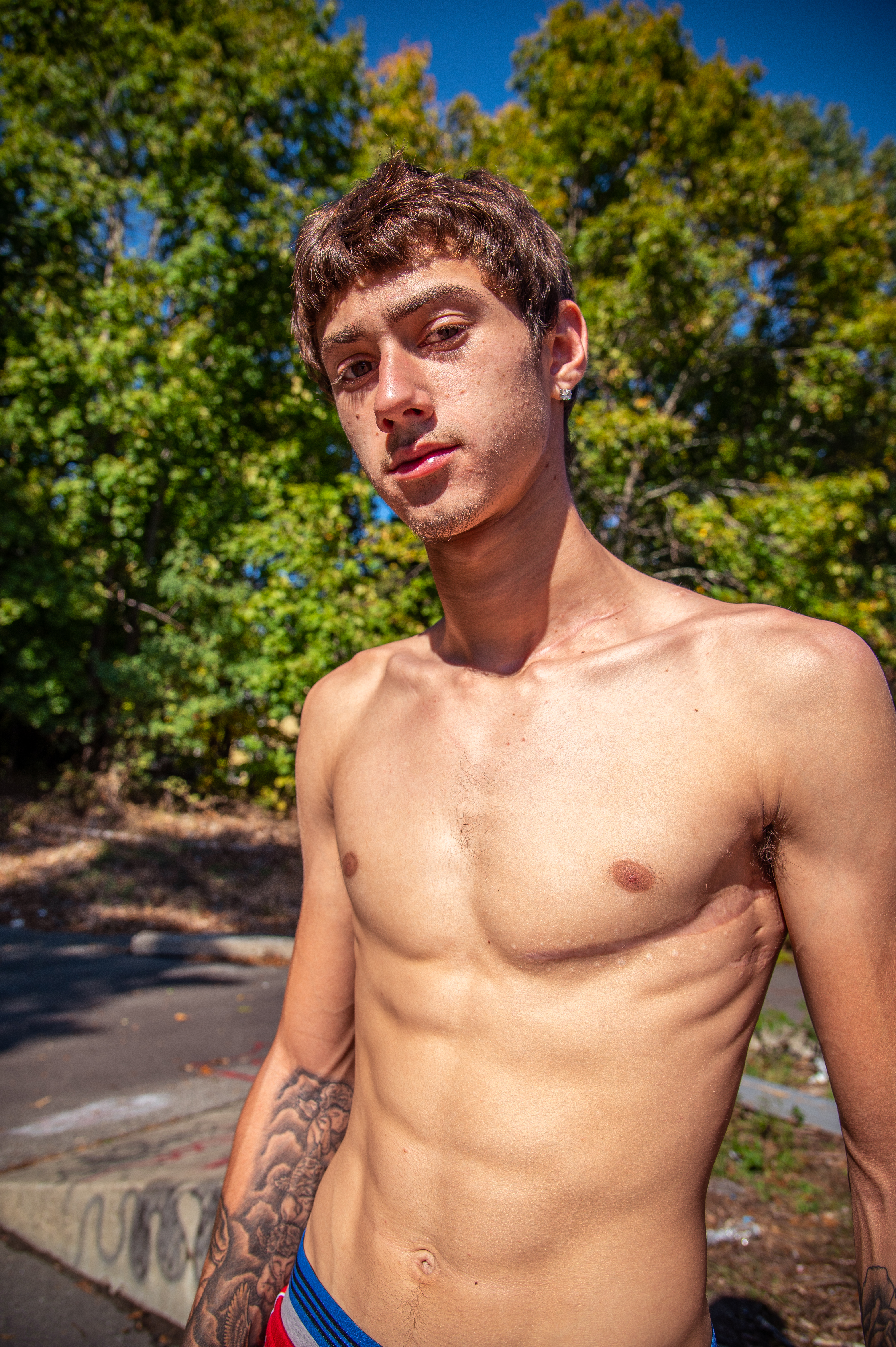 Sandonato bears multiple scars from a stray bullet that nearly took his life. A month after leaving the hospital, he was back riding.
