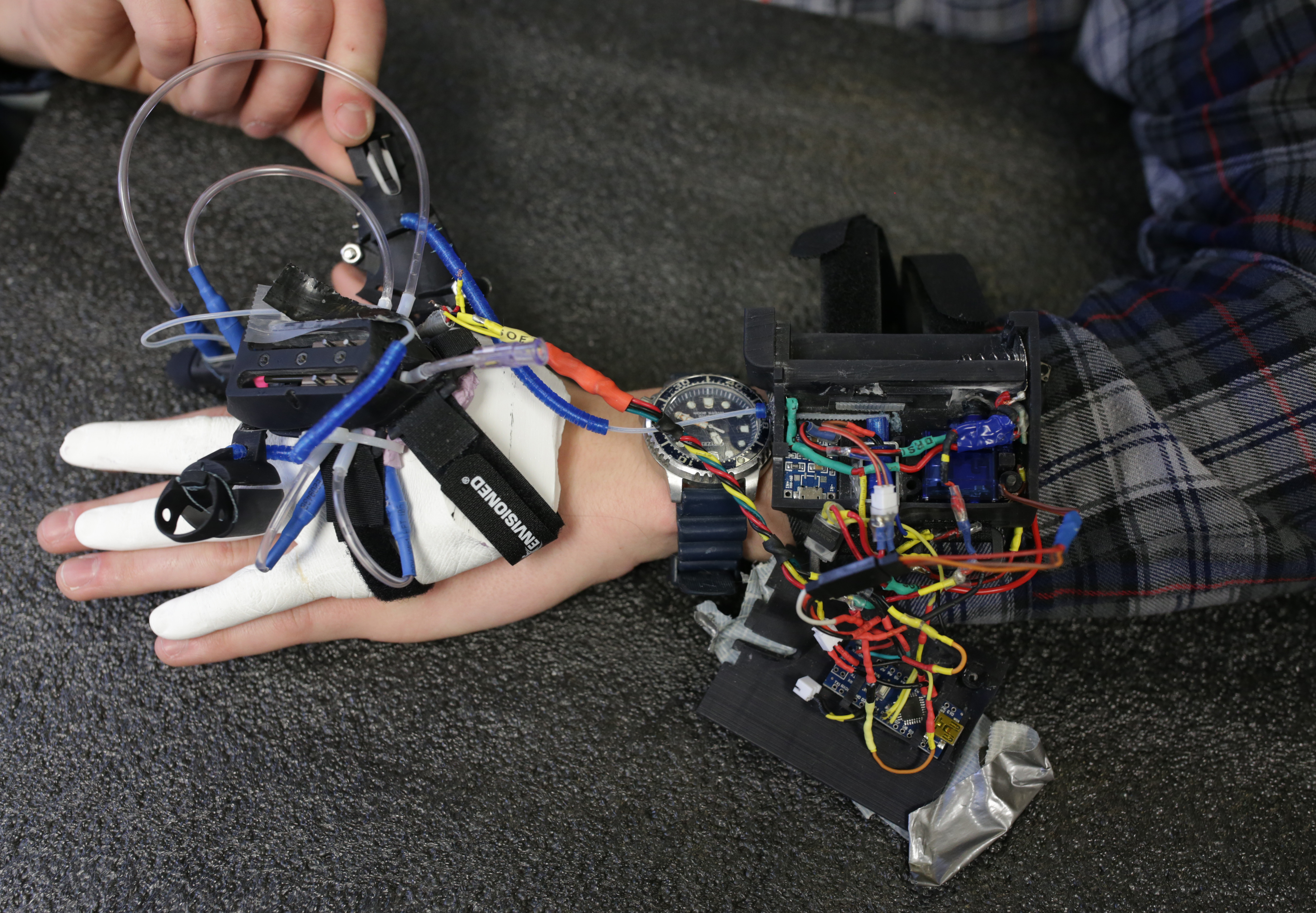 A partial hand prosthetic.