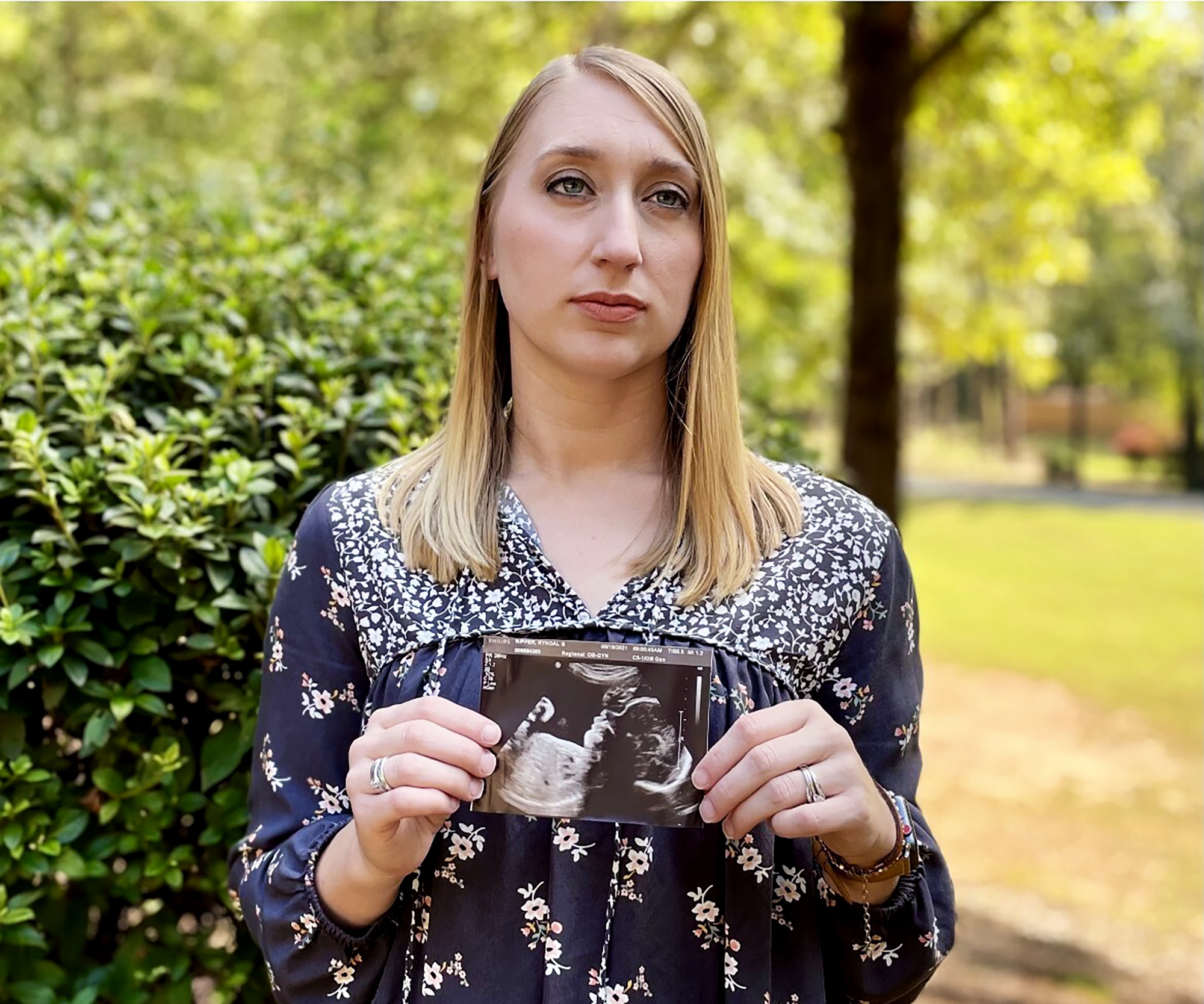 Kyndal Nipper, of Midland, Ga., who suffered a stillbirth after becoming ill with COVID-19 in her third trimester, holds an ultrasound image of the son she lost while standing outside her home on Friday, Oct. 15, 2021. Nipper, who was unvaccinated, is encouraging women to get vaccinated.