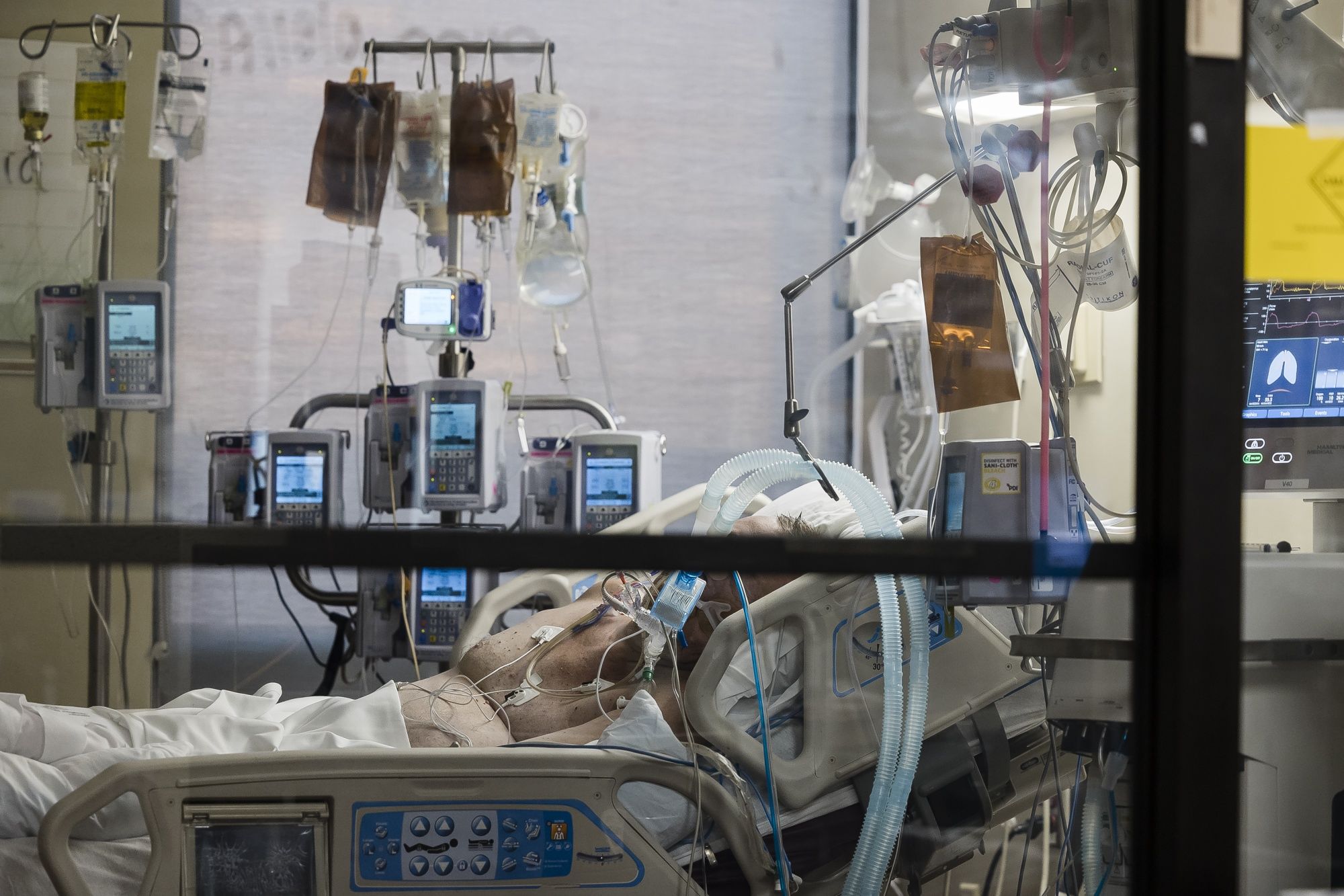 An intubated patient inside a negative pressure room in the Covid-19 ICU at a hospital West in Joplin, Missouri on Aug. 3.