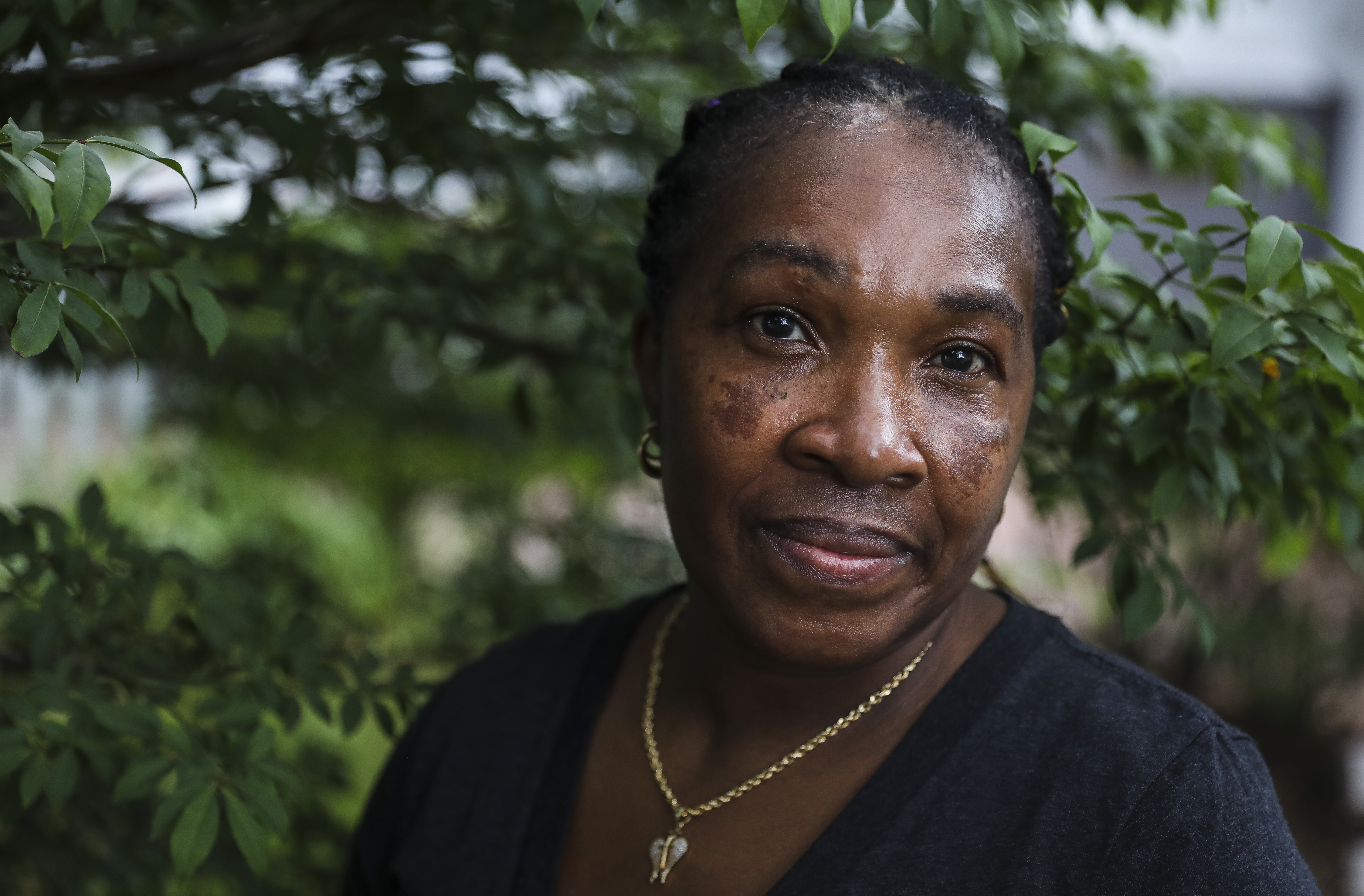 A scar cuts through Elaine Griffiths' right eyebrow, one of many injuries she suffered after being struck by a car in a hit-and-run a few years ago. She said police have not contacted her to investigate the incident.