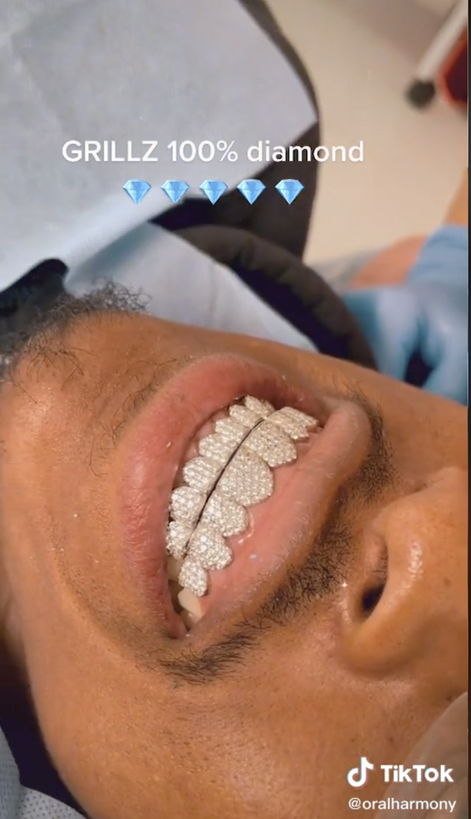 Los riesgos de tener joyas en los dientes a lo Rosalía - La Tercera
