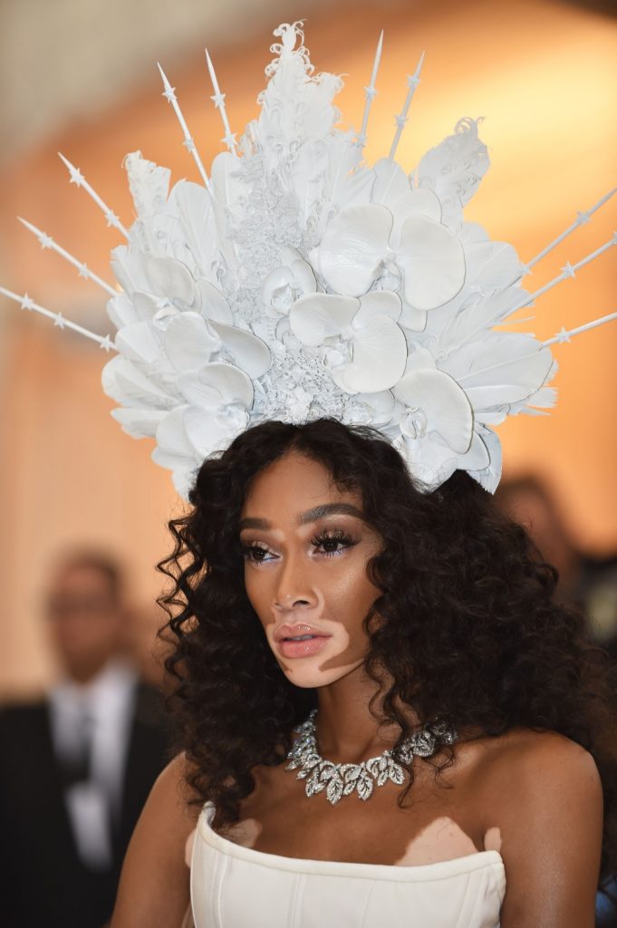 Winnie Harlow, la modelo con vitiligo que desfilará para Victoria's Secret  | La Prensa Panamá