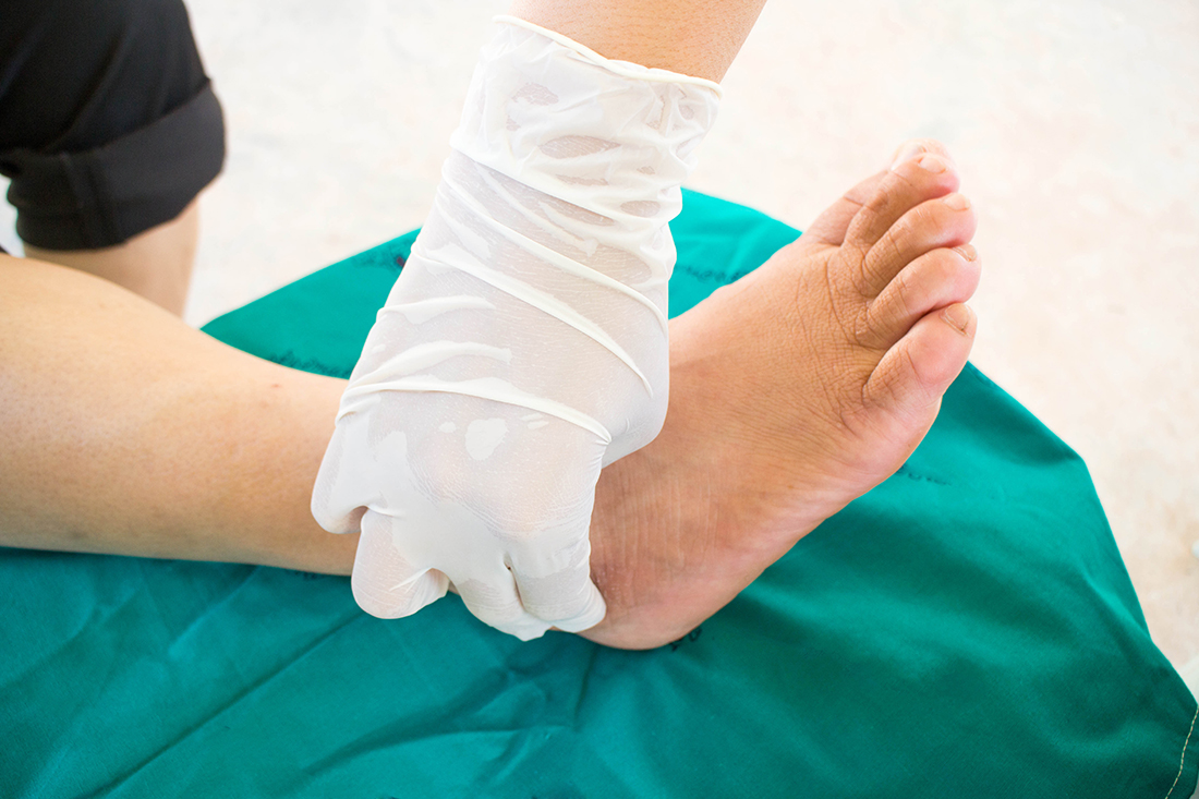 SPONSORED: New provides relief Charcot foot patients