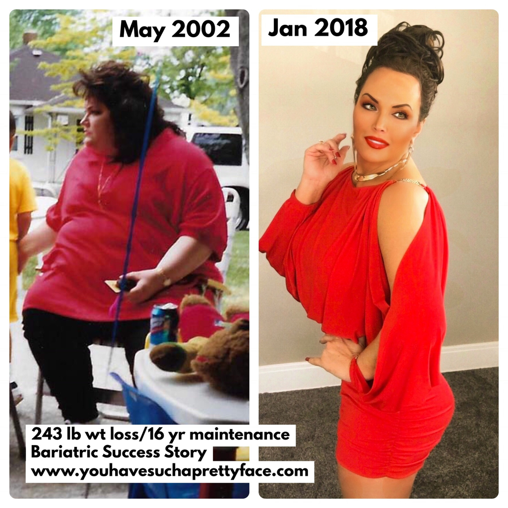 Troy resident Kelley Gunter, the author of the new book "You Have Such a Pretty Face," loss 243 with the help of weight loss surgery in 2002. She says true transformation came when he sought help for her destructive behavior. She lives with her son Alec and three Rottweilers.